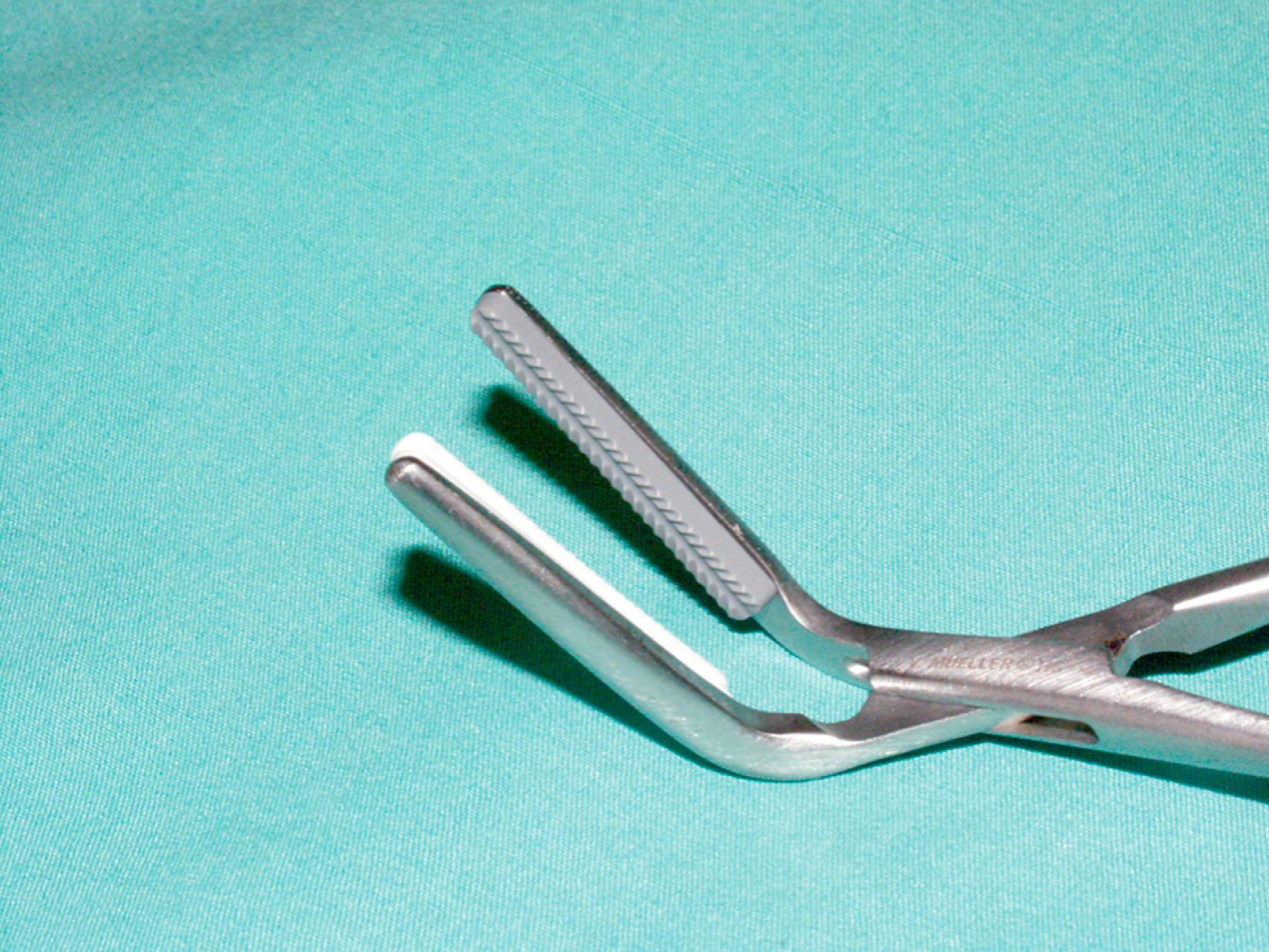 eFigure 61.10, Jaw of Fogarty clamp.