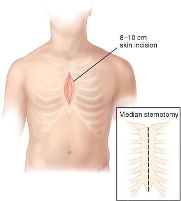 FIGURE 4-2