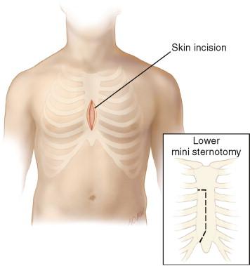 FIGURE 4-6