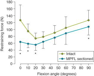 FIG 35-3, Patellar lateral displacing force at 10 mm displacement, for an intact knee with 175-N quadriceps tension, and after transection of the medial patellofemoral ligament (MPFL). The drop between the two curves shows that the contribution of the MPFL was greatest in the extended knee. Asterisks denote significant difference ( P value not provided).