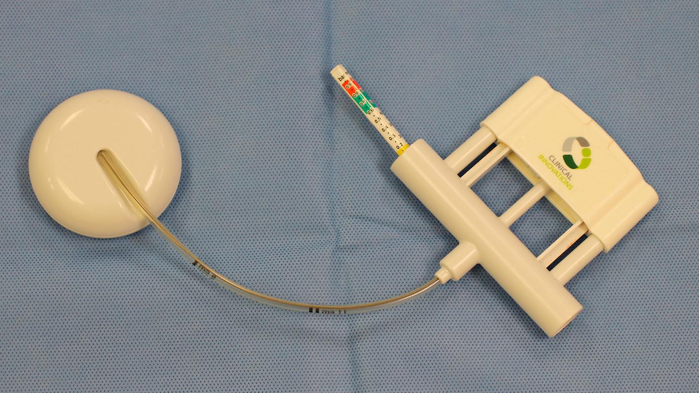 Fig. 10.1, Photograph of vacuum extractor. Device pictured is Kiwi complete vacuum delivery system by Clinical Innovations.