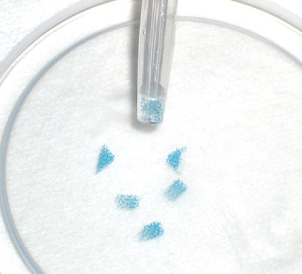 Figure 3.6, Transferring biopsy specimens. For the pipette transfer method, the pipette tip is cut off to provide a wider orifice.