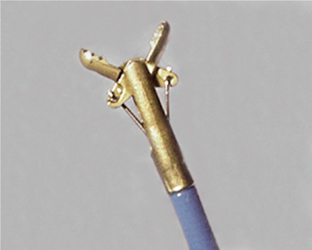 Figure 3.7, Transbronchial biopsy. The cupped biopsy forceps with open jaws is commonly used for transbronchial biopsy.
