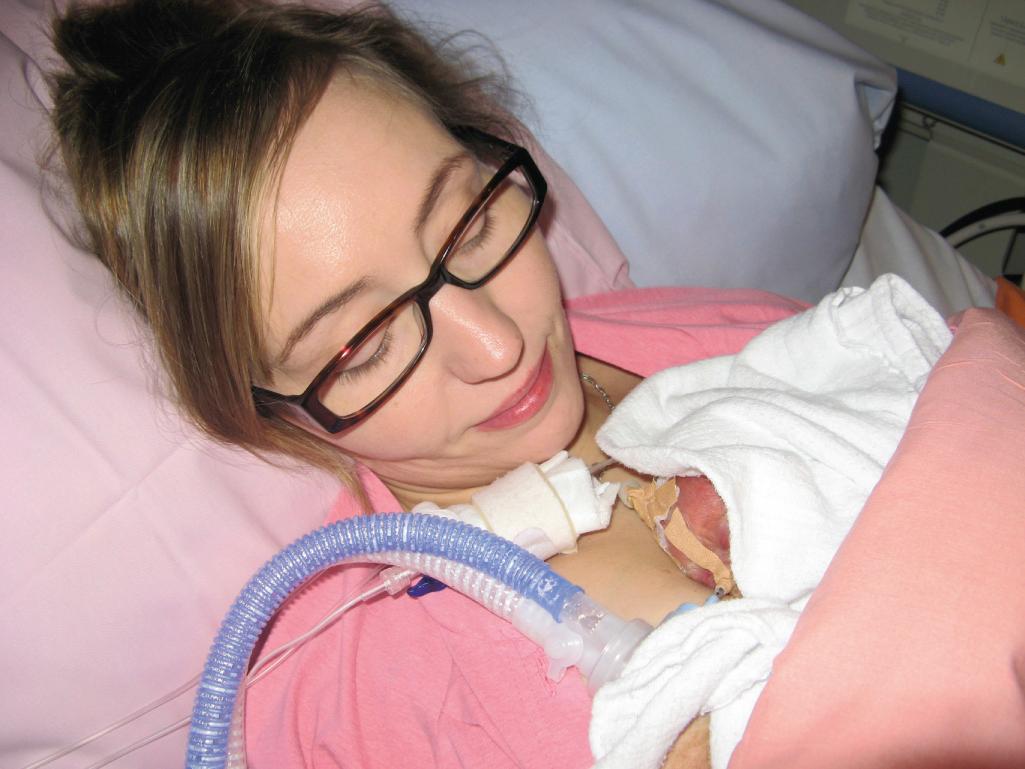 Fig. 36.3, Four-day-old infant born at 25 weeks’ gestation is skin-to-skin with her mother while on the ventilator, receiving tube feedings and parenteral nutrition via a PICC line. Daily skin-to-skin care was started on the second day of life and continued throughout the hospital stay.