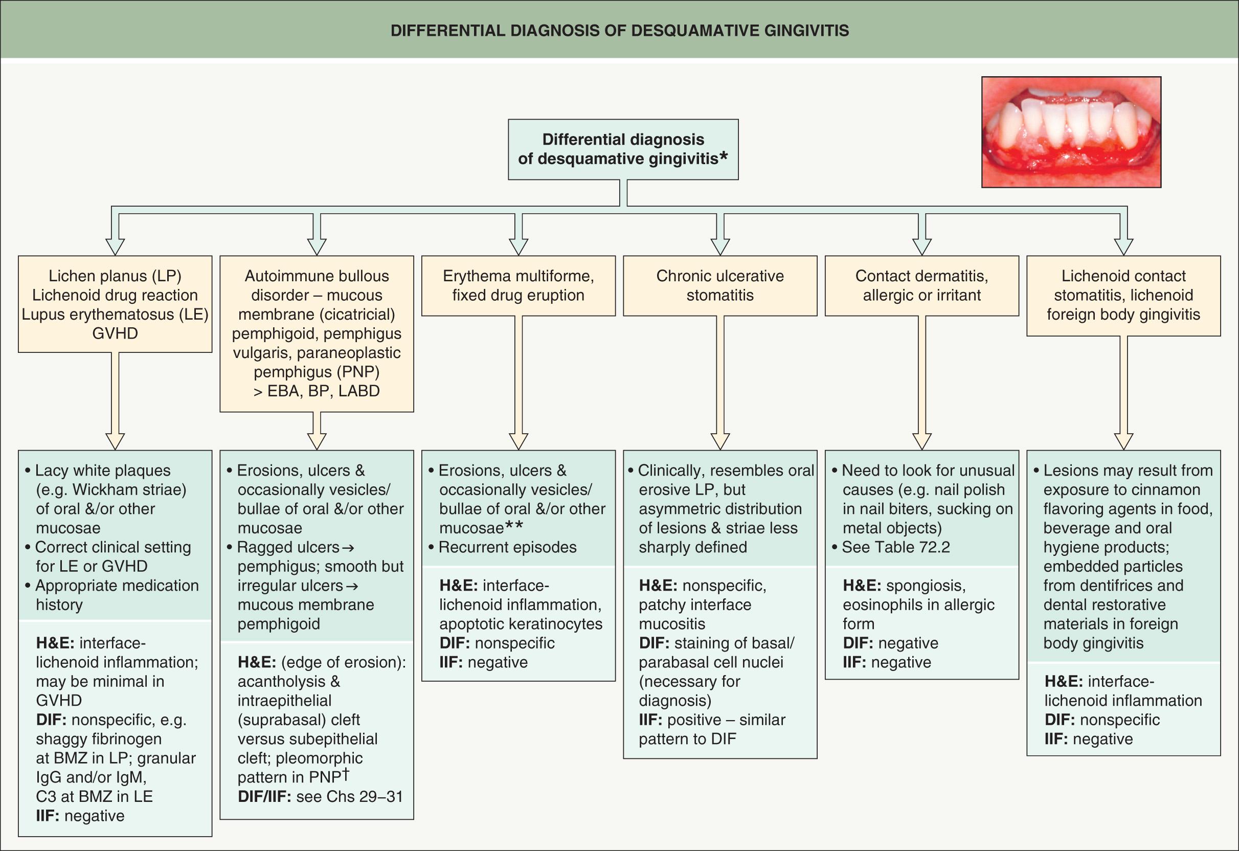 Fig. 72.7, Differential diagnosis of desquamative gingivitis.