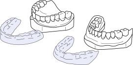 Fig. 61.1, Drawing of dental trays for upper and lower teeth.