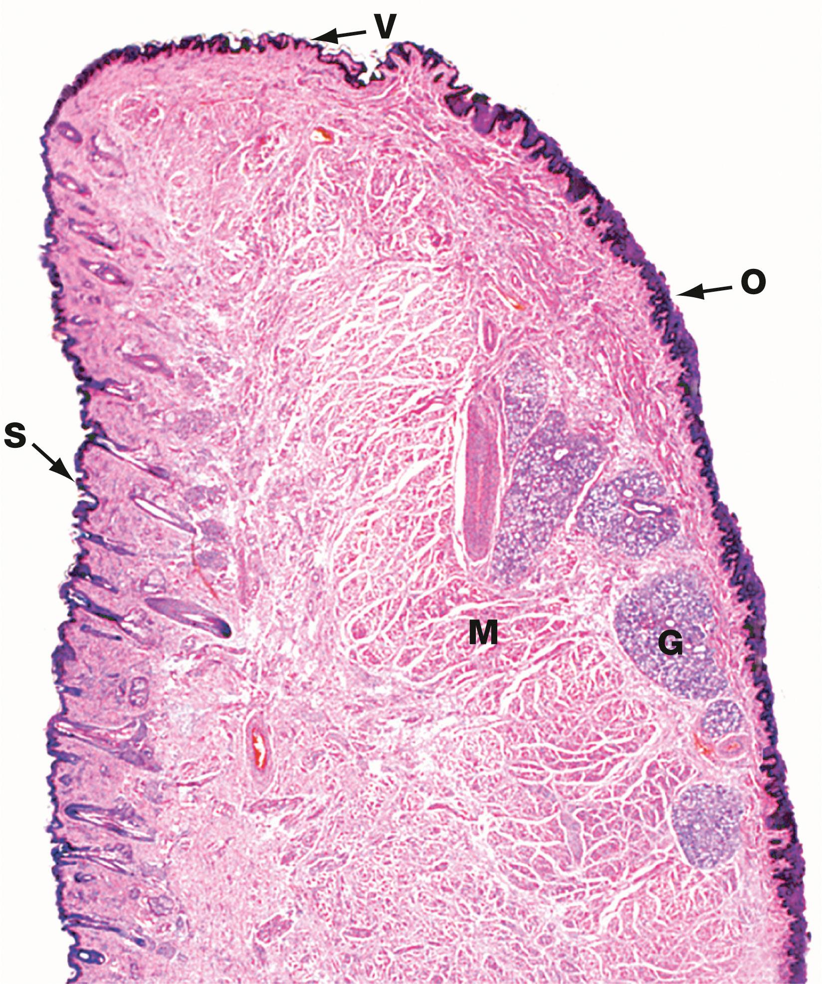 Fig. 13.1, Lip