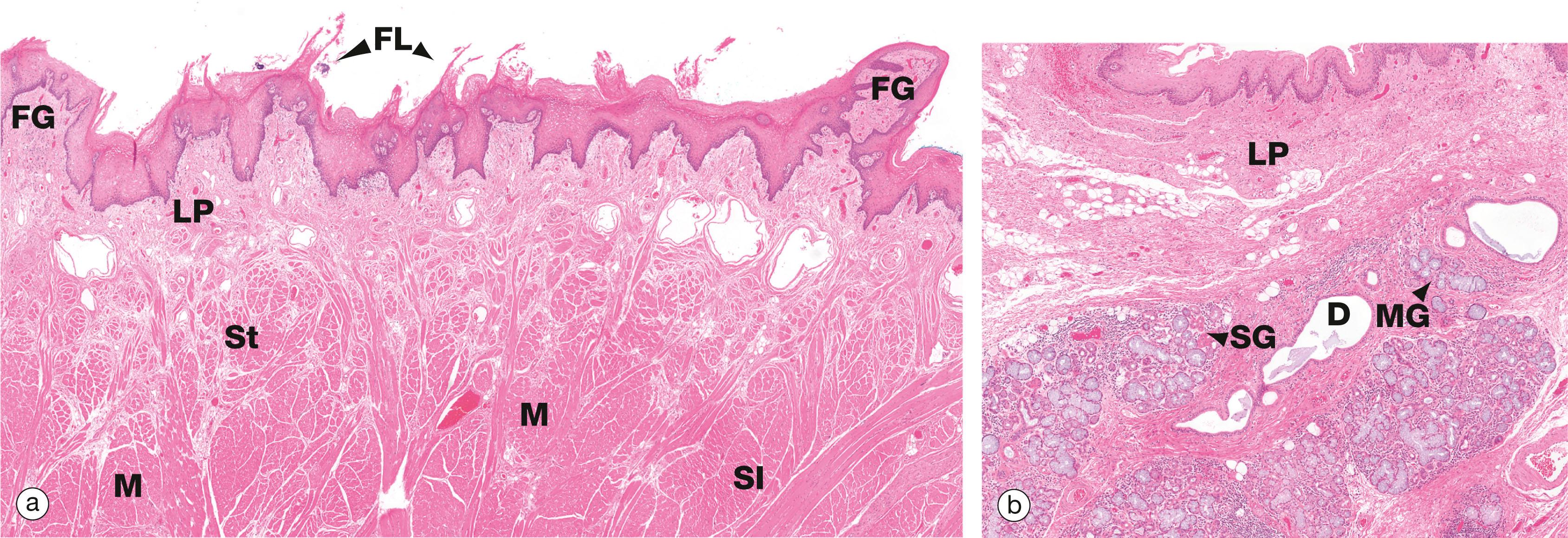 Fig. 13.10, Tongue, anterior two-thirds