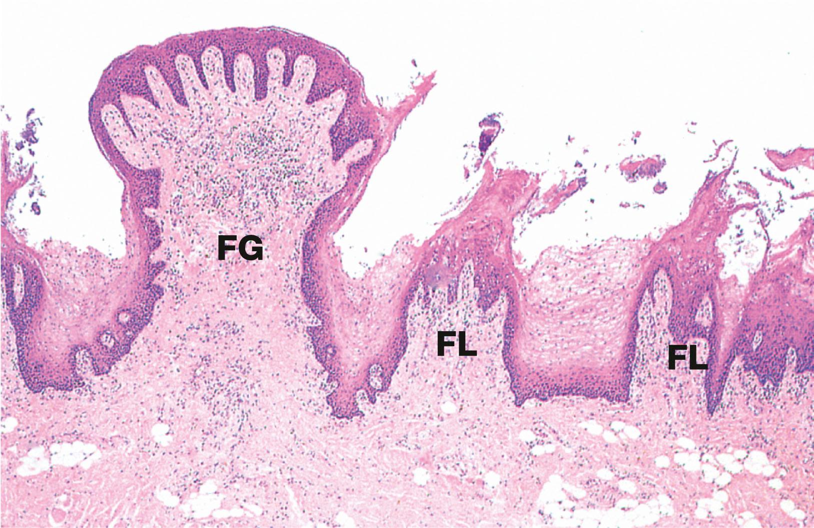 Fig. 13.11, Filiform and fungiform papillae