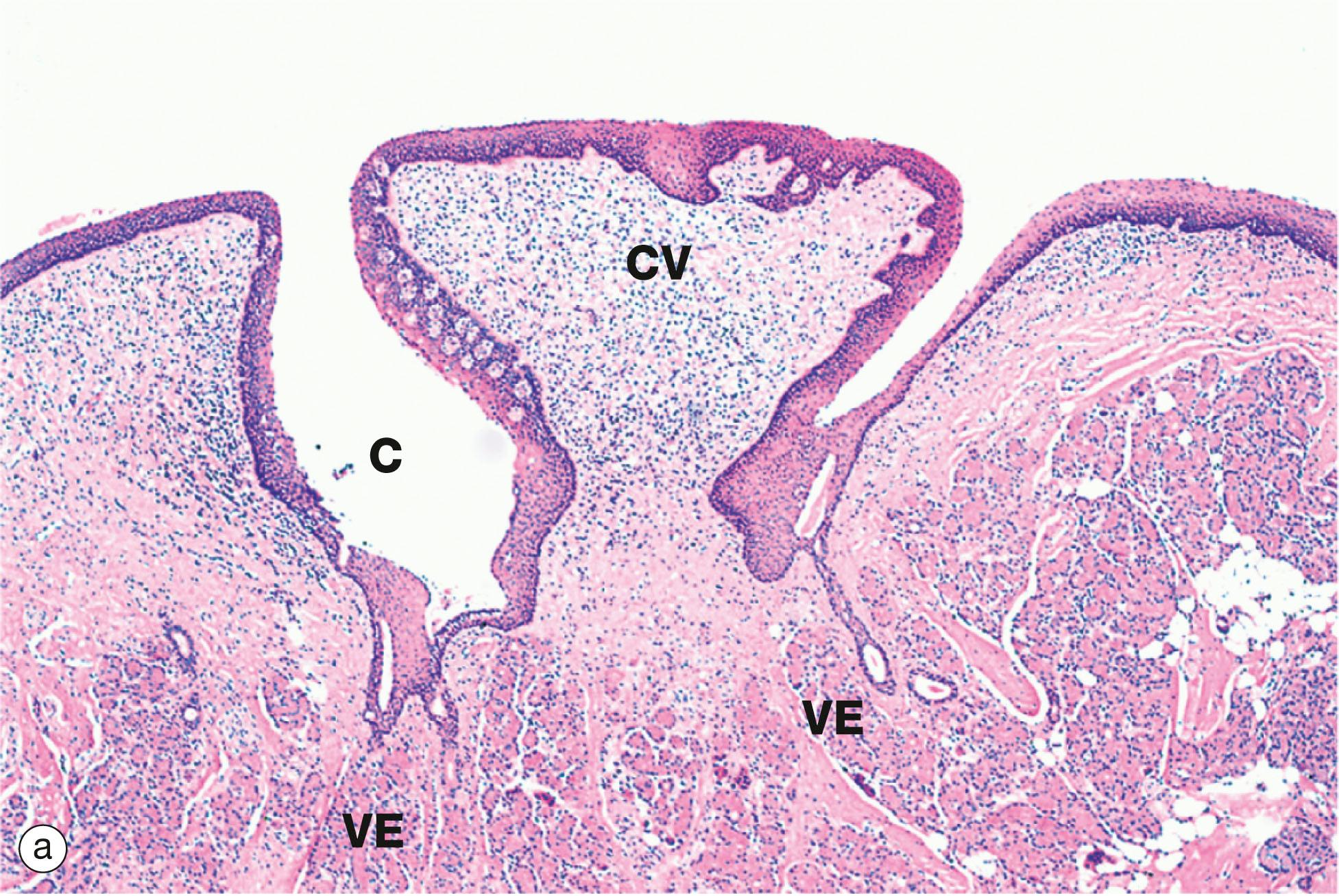 Fig. 13.12, Circumvallate papillae