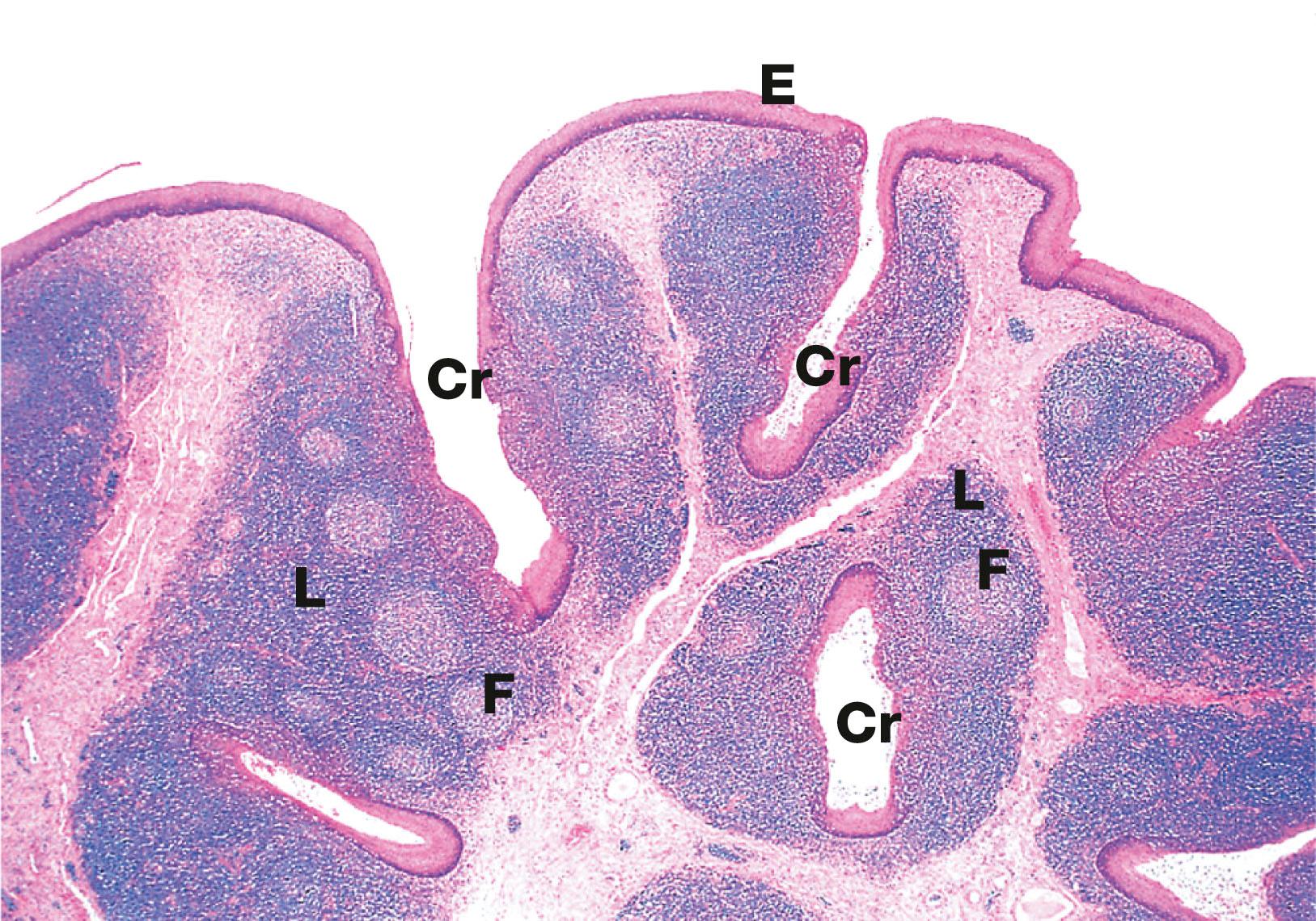 Fig. 13.13, Tongue, posterior third