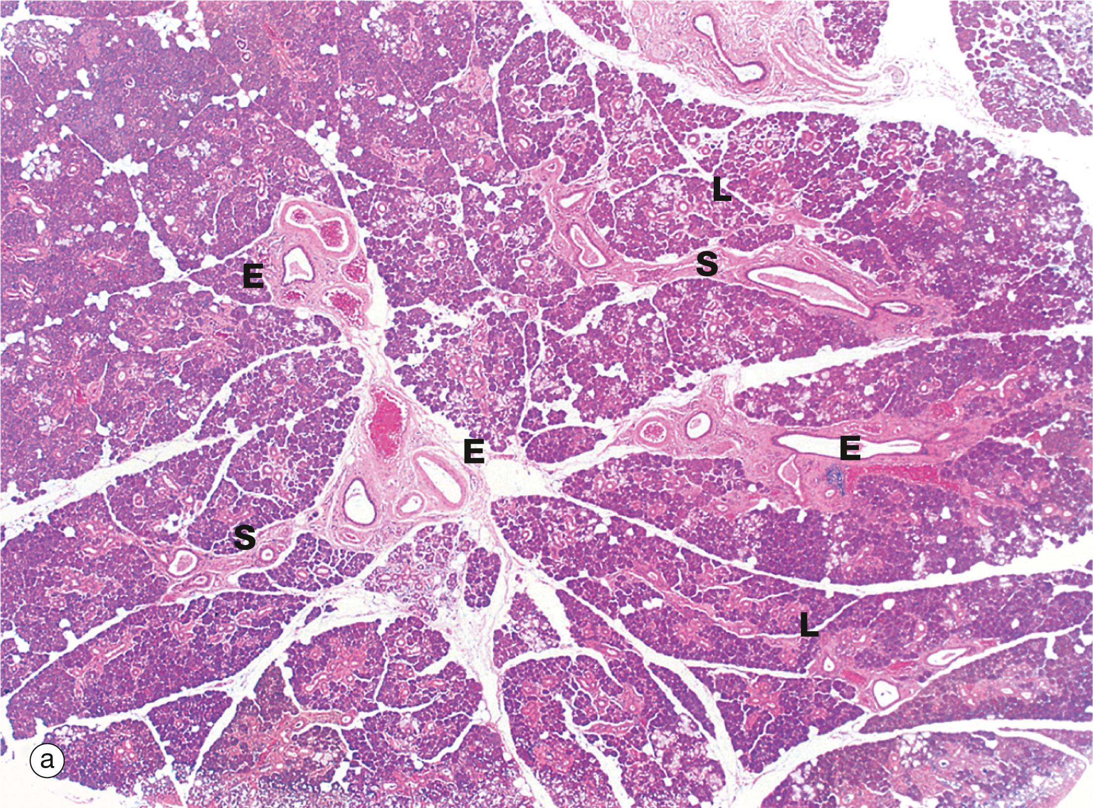 Fig. 13.16, Parotid gland