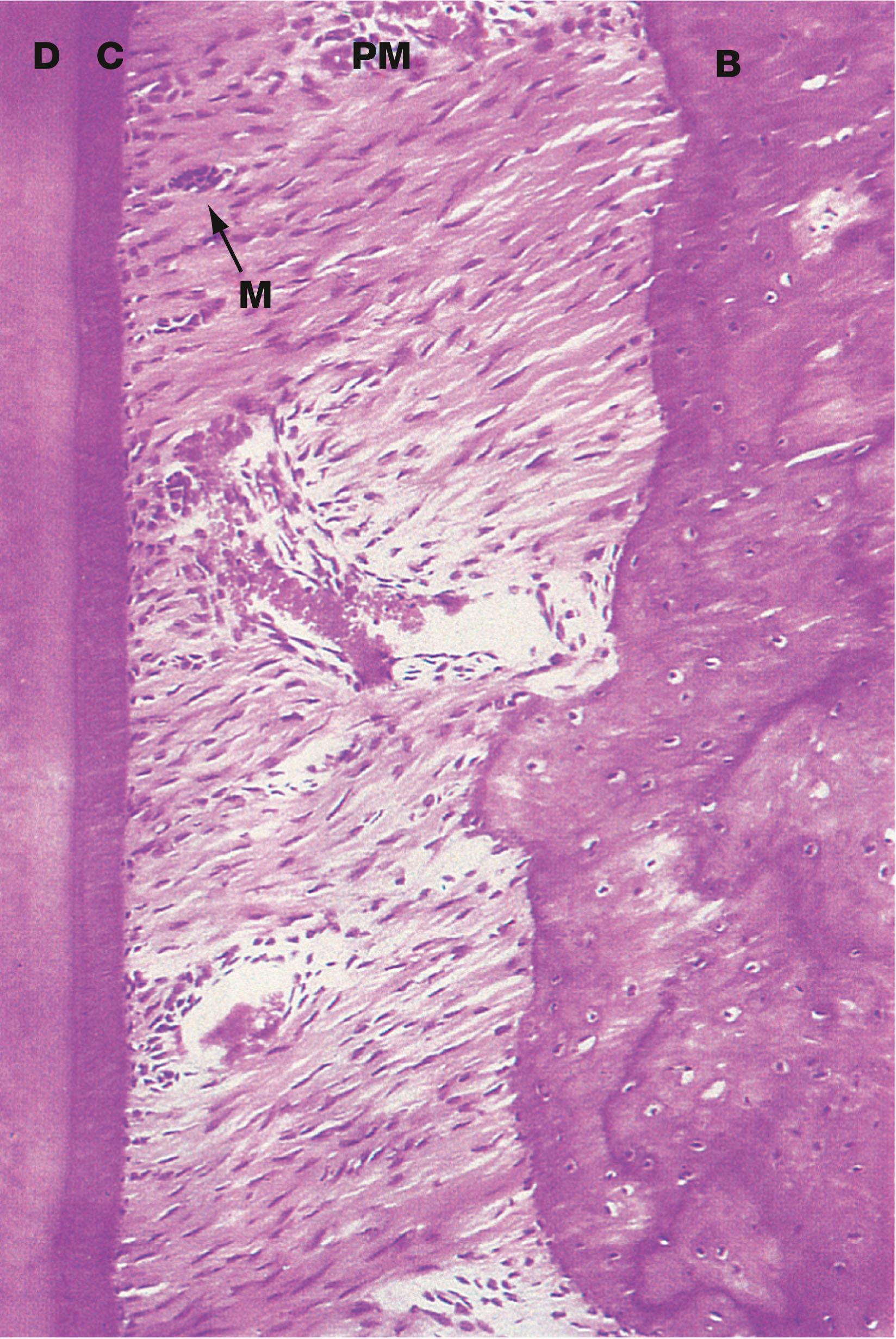 Fig. 13.8, Periodontal membrane and cementum