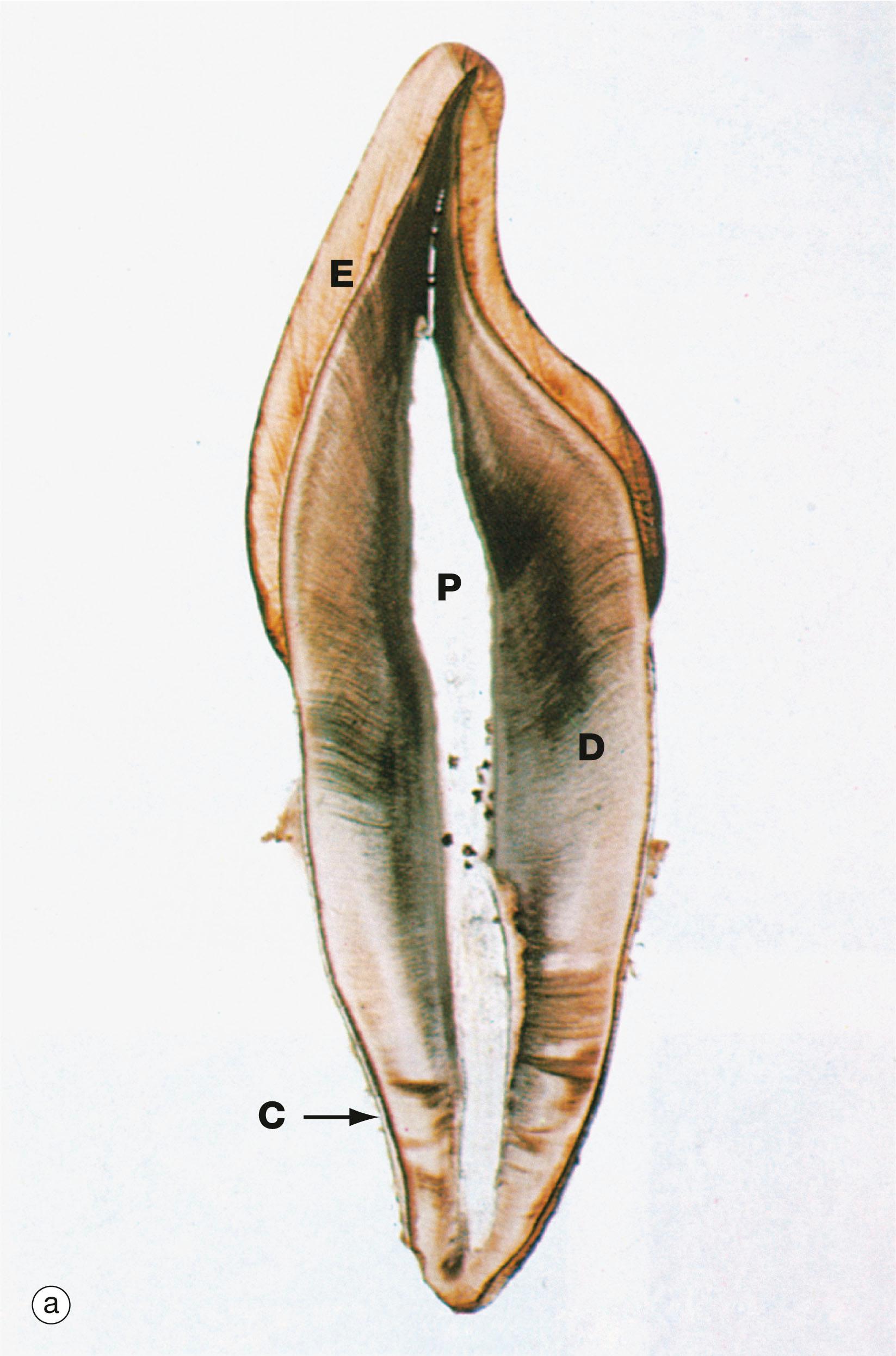 Fig. 13.4, Tooth structure