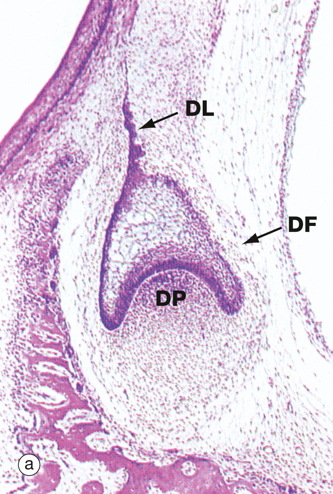 Fig. 13.5, Tooth development (caption opposite)