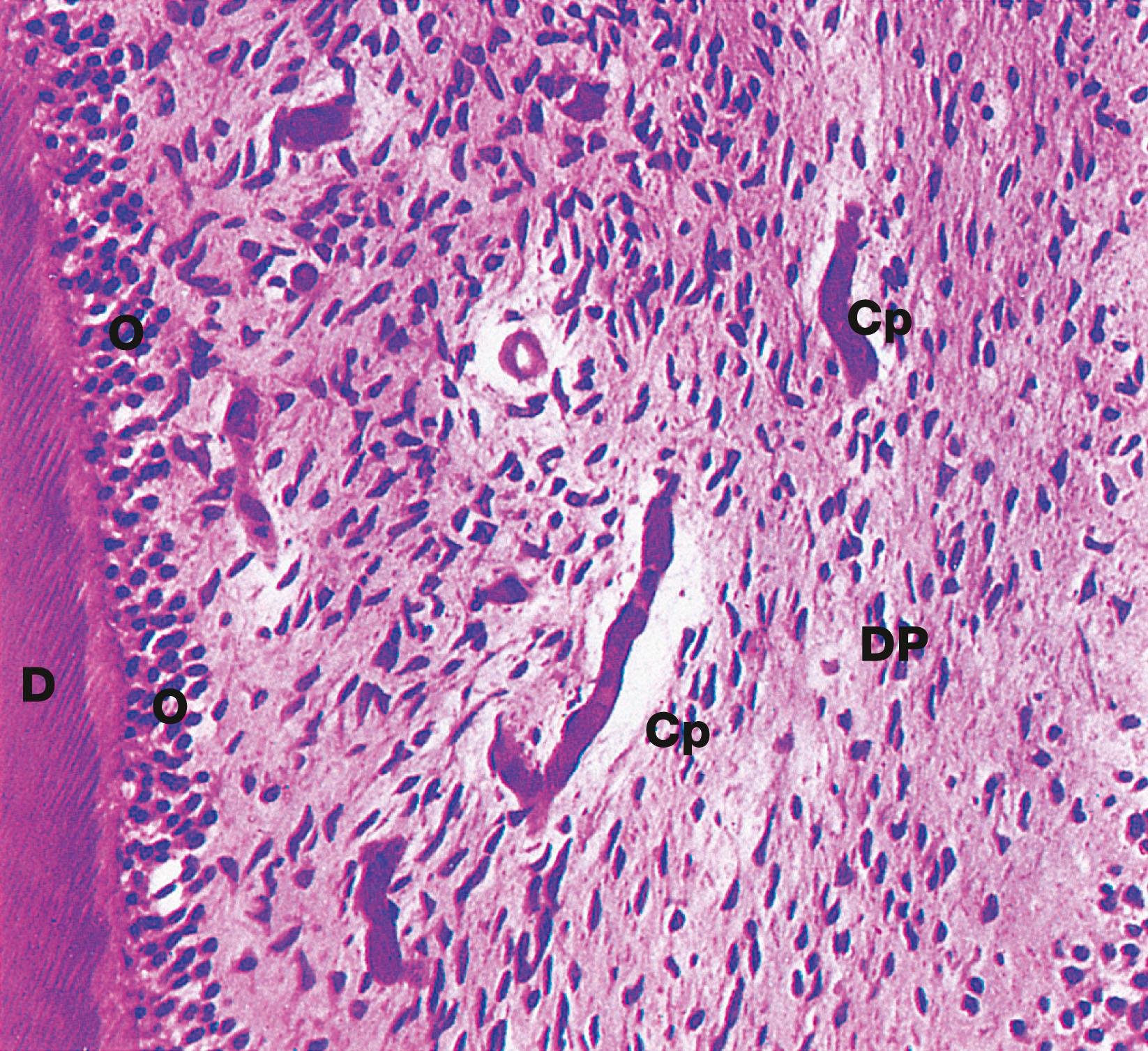 Fig. 13.7, Dental pulp