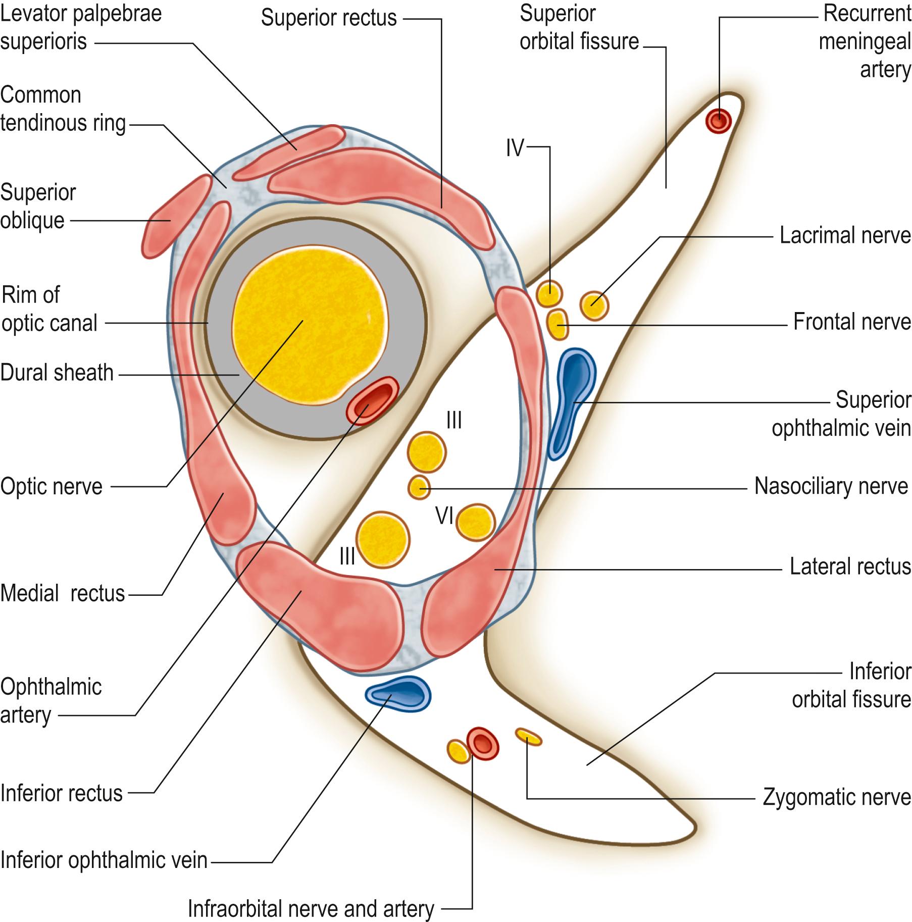 Fig. 44.4, The common tendinous ring: muscle origins have been superimposed. The relative positions of the nerves and vessels that enter the orbital cavity by passing through the superior orbital fissure or optic canal are shown. Note that the attachments of levator palpebrae superioris and superior oblique lie external to the common tendinous ring but are attached to it. The ophthalmic veins frequently pass through the ring. The recurrent meningeal artery (a branch of the ophthalmic artery) is often conducted from the orbit to the cranial cavity through its own foramen. Abbreviations: III, oculomotor nerve; IV, trochlear nerve; VI, abducens nerve.