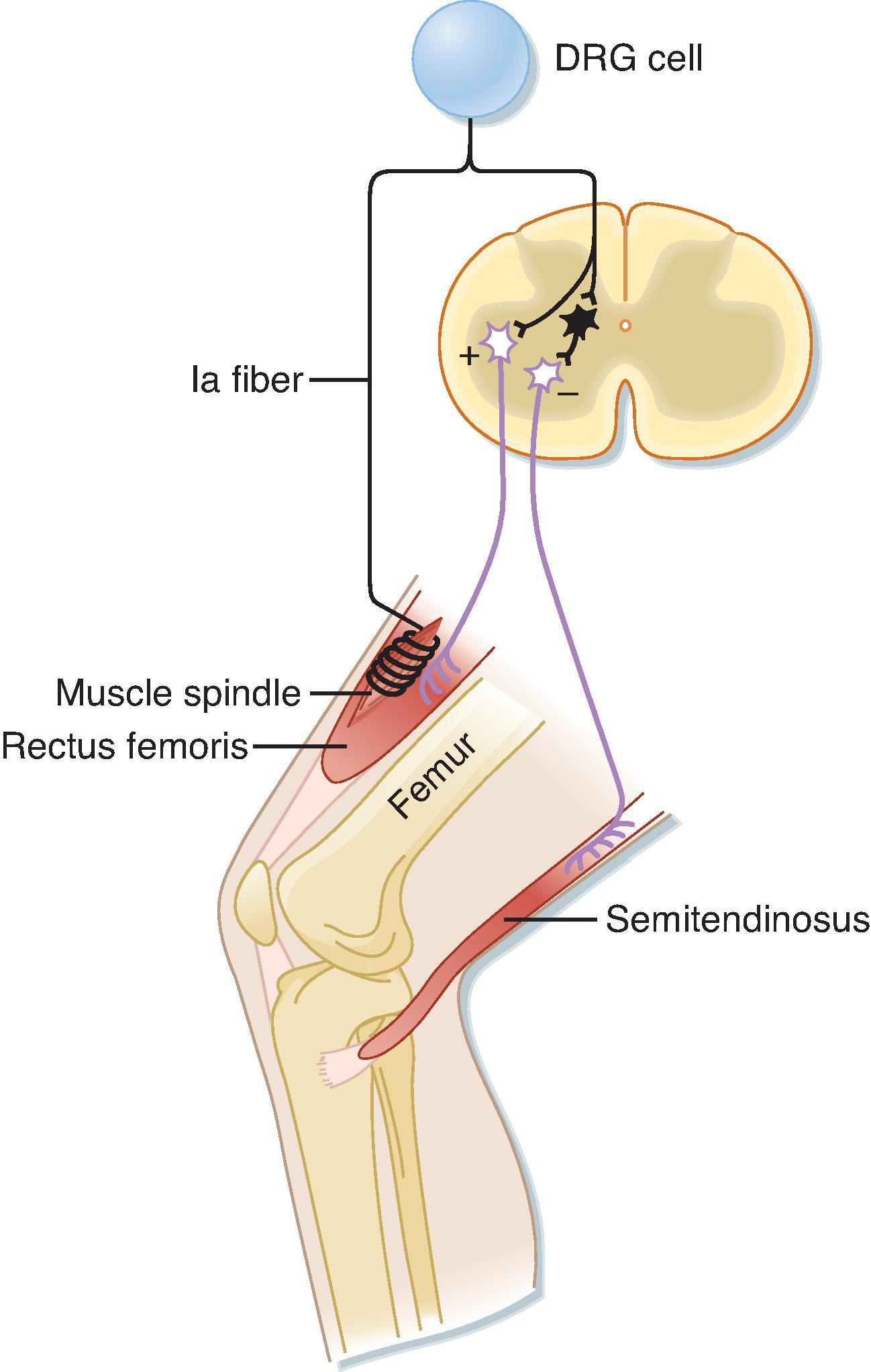 Fig. 9.6, Reflex arc of the stretch reflex. The pathway back to the rectus femoris in this arc contains a single synapse within the central nervous system; hence, it is a monosynaptic reflex. The interneuron, shown in black, is a group Ia inhibitory interneuron. DRG , Dorsal root ganglion.