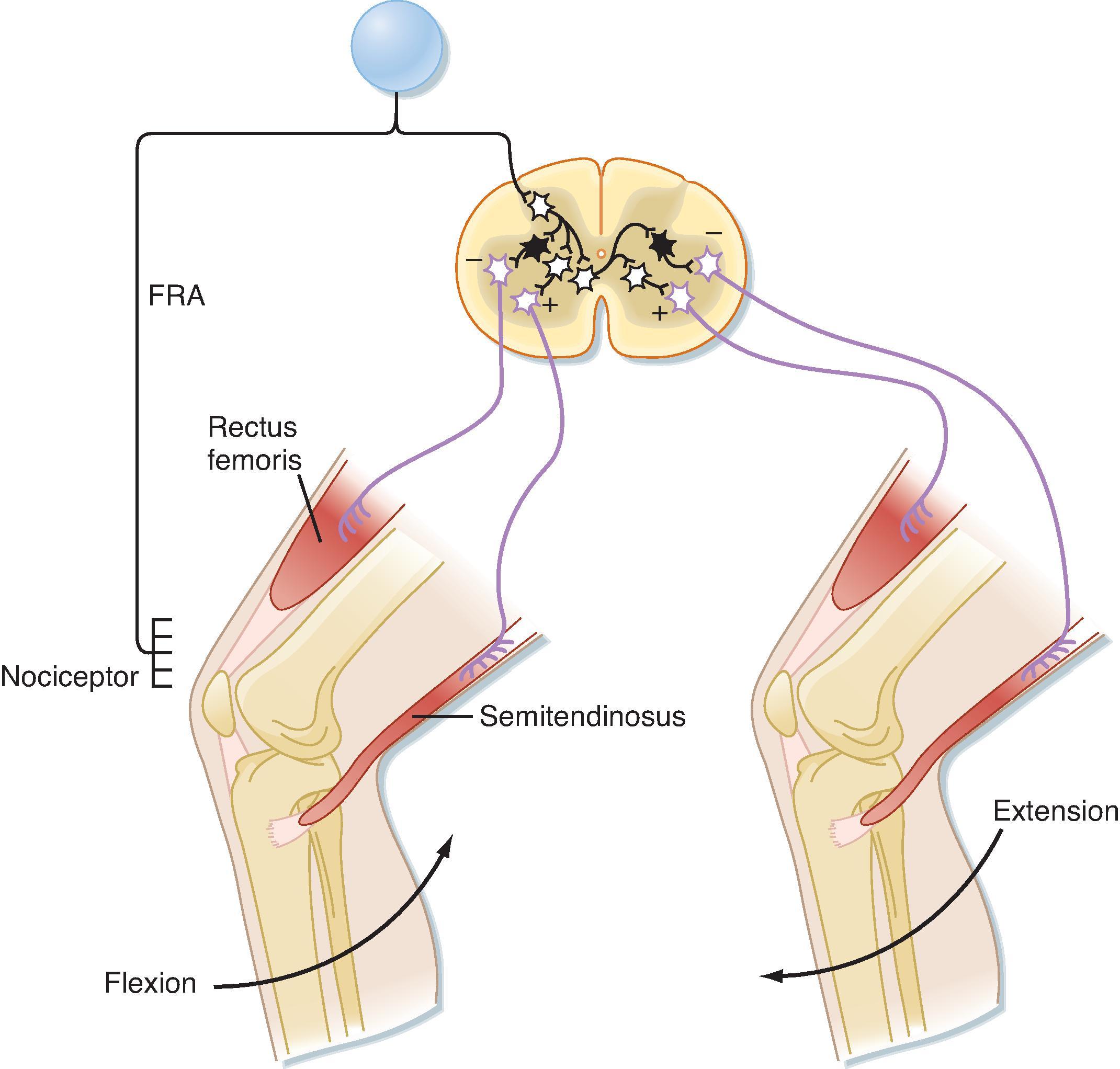 Fig. 9.9, The reflex arc of the flexion reflex. Black interneurons are inhibitory, and white ones are excitatory. FRA , Flexion reflex afferent fiber.