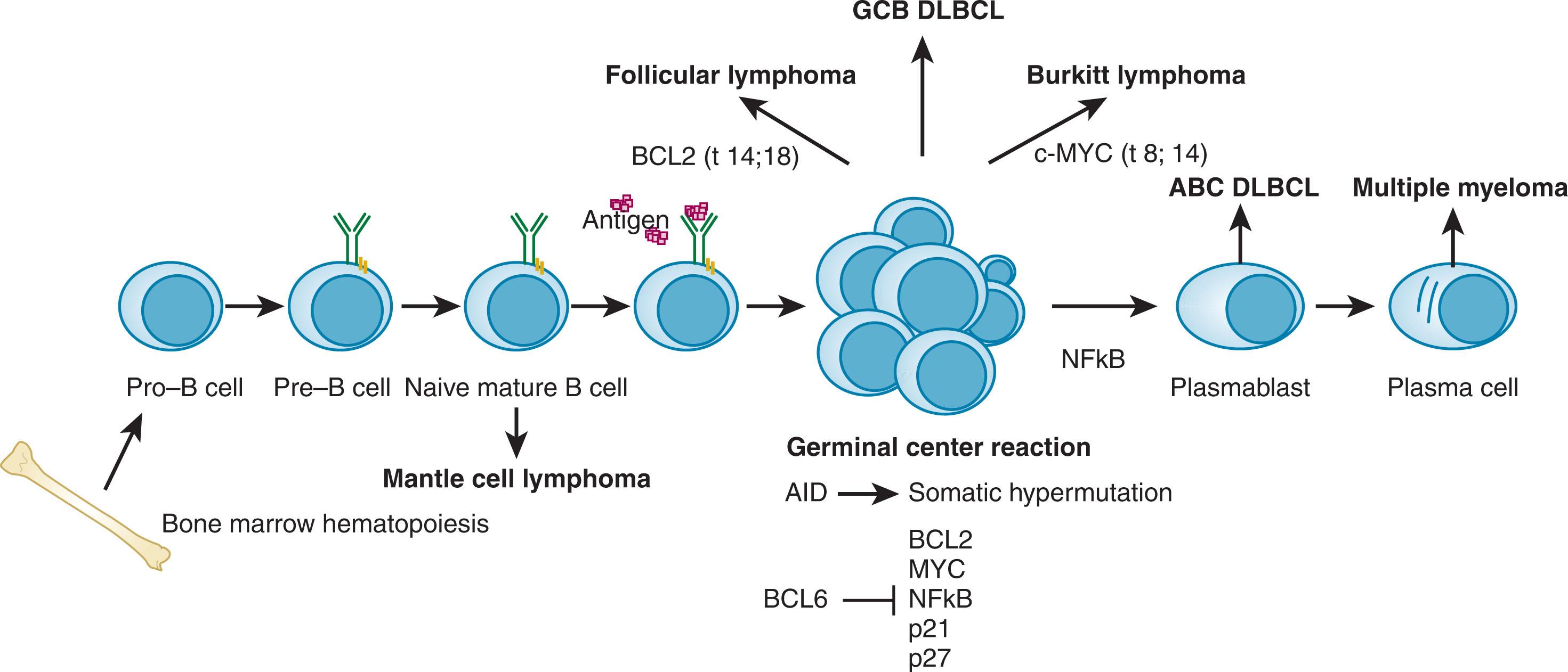 Figure 81.2, CLASSIFICATION OF COMMON NON-HODGKIN LYMPHOMAS (NHLs) IN RELATION TO B-CELL DEVELOPMENT IN GERMINAL CENTERS (GCs).