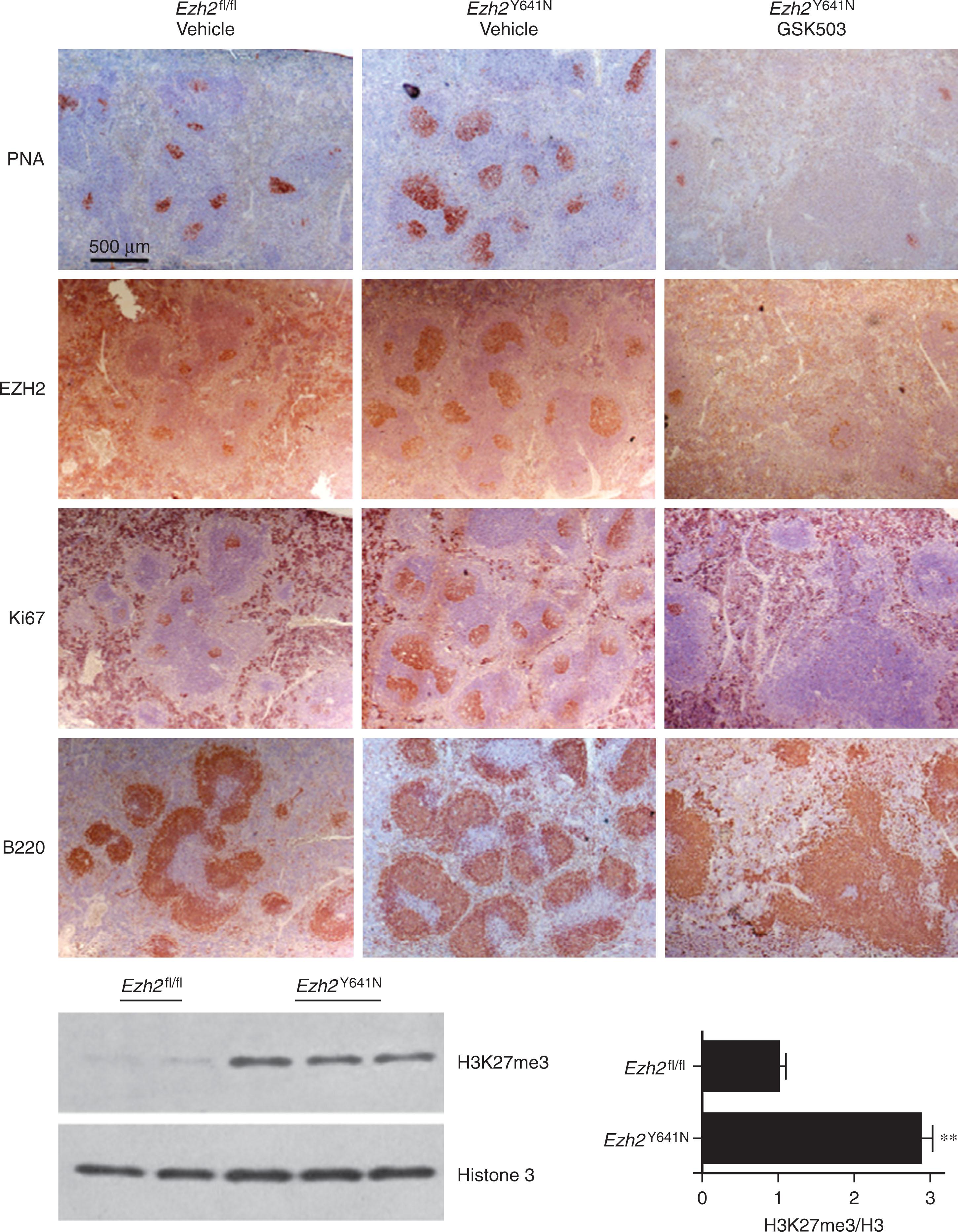 Figure 81.3, EXPANSION OF GERMINAL CENTERS WITH EZH2 MUTATION CONFERRING INCREASED HISTONE 3 LYSINE 36 TRIMETHYLATION (H3K36ME3).