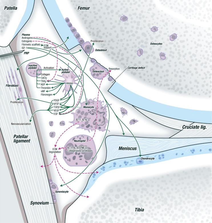 Fig. 5.1, The effect of various components of platelet-rich plasma on different types of tissues surrounding a joint. ADP, Adenosine diphosphate; bFGF, basic fibroblast growth factor; CaCl 2 , calcium chloride; ECM, extracellular matrix; EGF, epidermal growth factor; IGF, insulin growth factor; IL, interleukin; PDGF, platelet-derived growth factor; PRP, platelet-rich plasma; TGF-β1, transforming growth factor-β1; TNF, tumor necrosis factor; TXA 2 , thromboxane A 2 ; VEGF, vascular endothelial growth factor; vWF , von Willebrand factor.