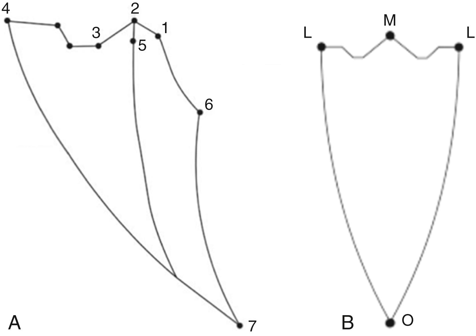 Fig. 21.5, Posselt’s diagram. (A) The sagittal view: 1, centric relation; 2, maximal intercuspation; 3, edge to edge; 4, maximal protrusion; 5, resting position; 6, hinge axis terminating point; 7, maximal opening point. (B) The frontal view: M, maximal intercuspation; L, lateral deviation; O, maximal opening.