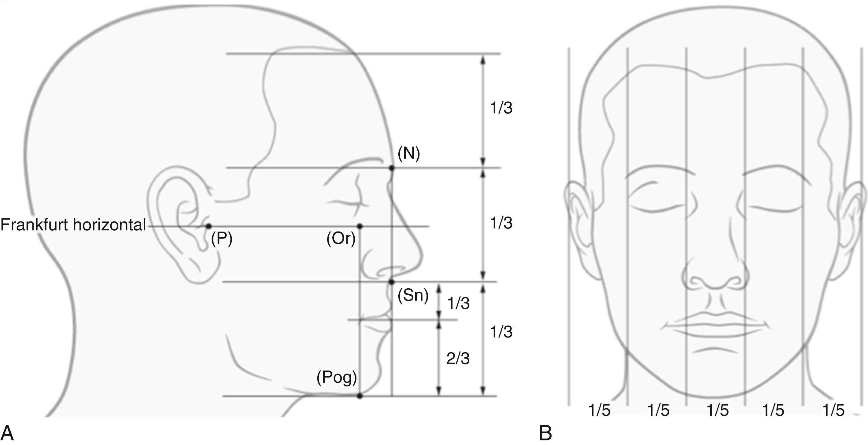 Fig. 21.6, Facial dimensions. (A) The proportionate facial thirds in the vertical dimension, while the facial fifths are shown in the horizontal dimension in (B).