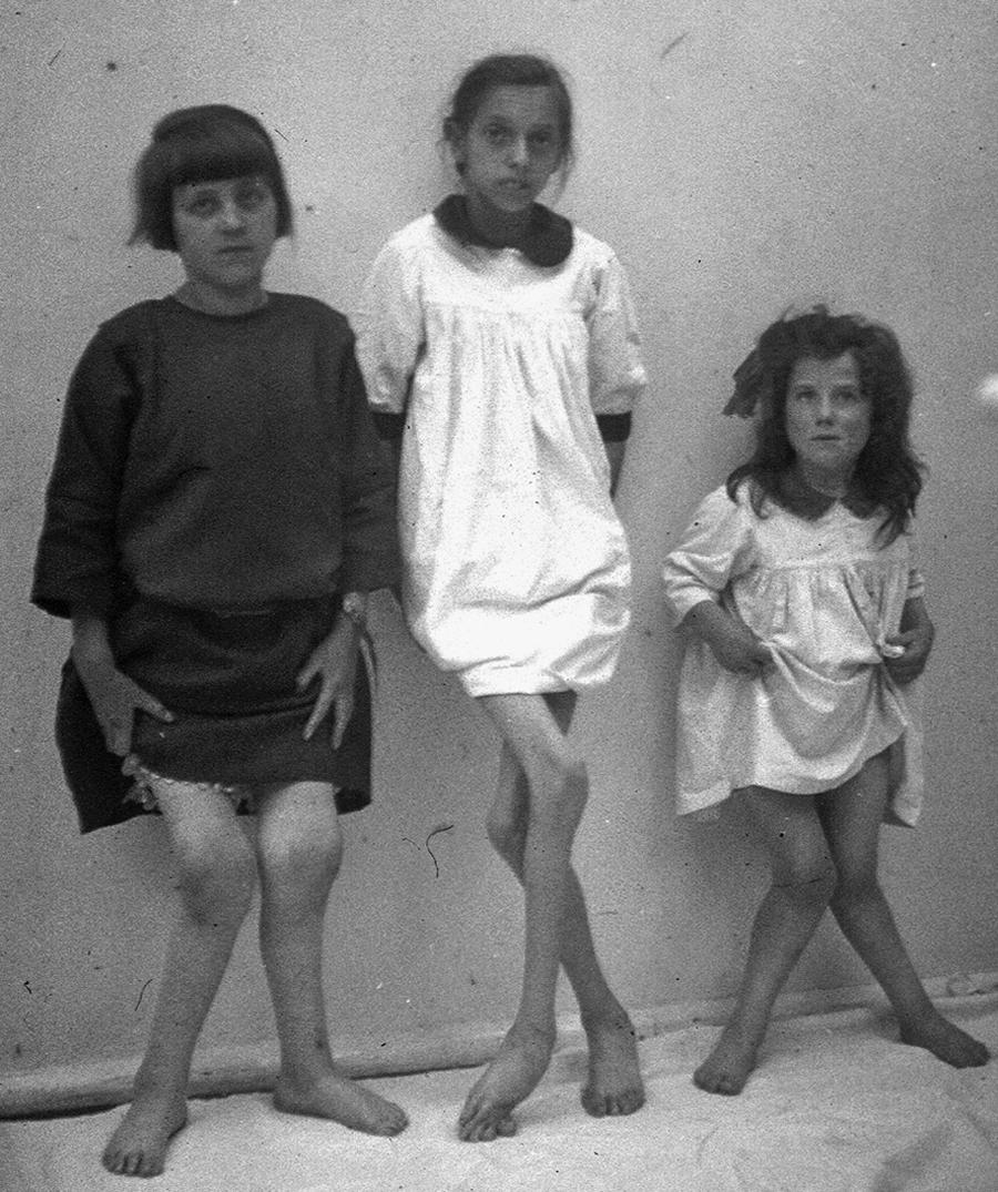 Fig. 28.4, Historical slide of children, showing deformities of the knees. All the children show valgus knee, i.e., knock-kneed, deformities.