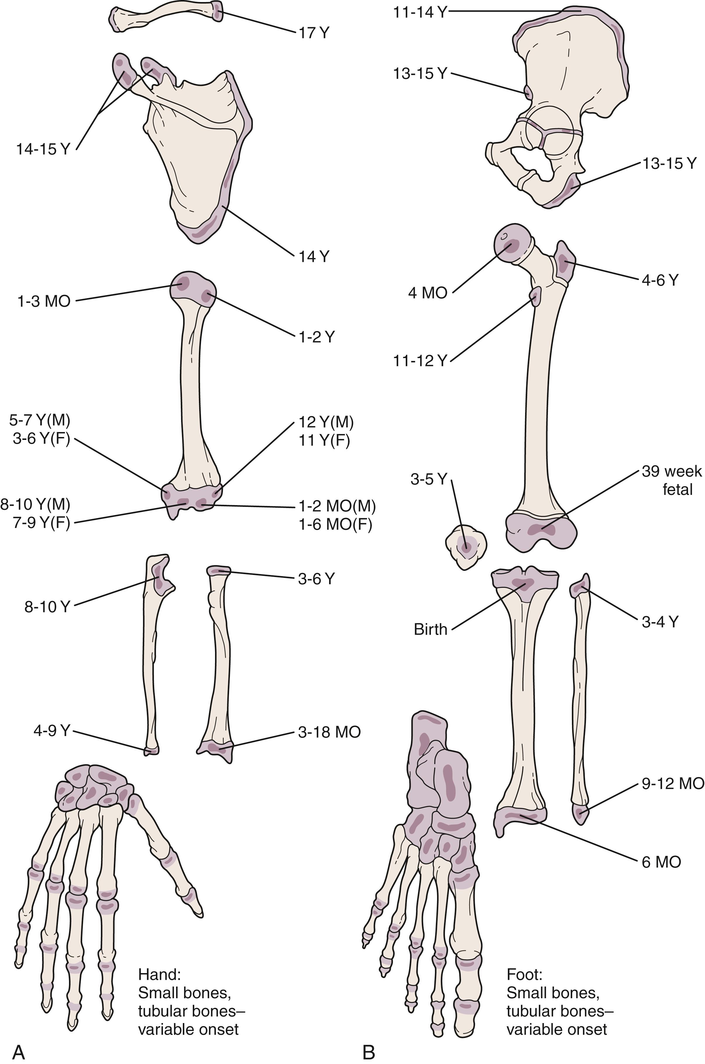 Fig. 22.1, Ages at onset of ossification for upper (A) and lower (B) extremities. At birth, only a few epiphyses have begun to ossify. The remainder are cartilaginous and therefore invisible radiographically. With development, other epiphyses begin to ossify, enlarge, and mature in an orderly fashion, making it possible to estimate a child’s age from the number and configuration of ossification centers. This forms the basis for the use of bone age as part of the evaluation of children with growth disorders. When evaluating the radiographs of injured children, it is of crucial importance to bear in mind that fractures involving nonossified epiphyses are radiographically invisible until healing begins (see Fig. 22.57 ). F, Female; M, male; MO, months; Y, years.