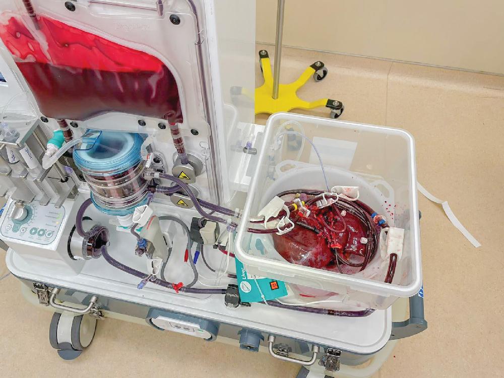 FIGURE 109.4, Depiction of a liver perfusion device in use at Washington University in St. Louis.