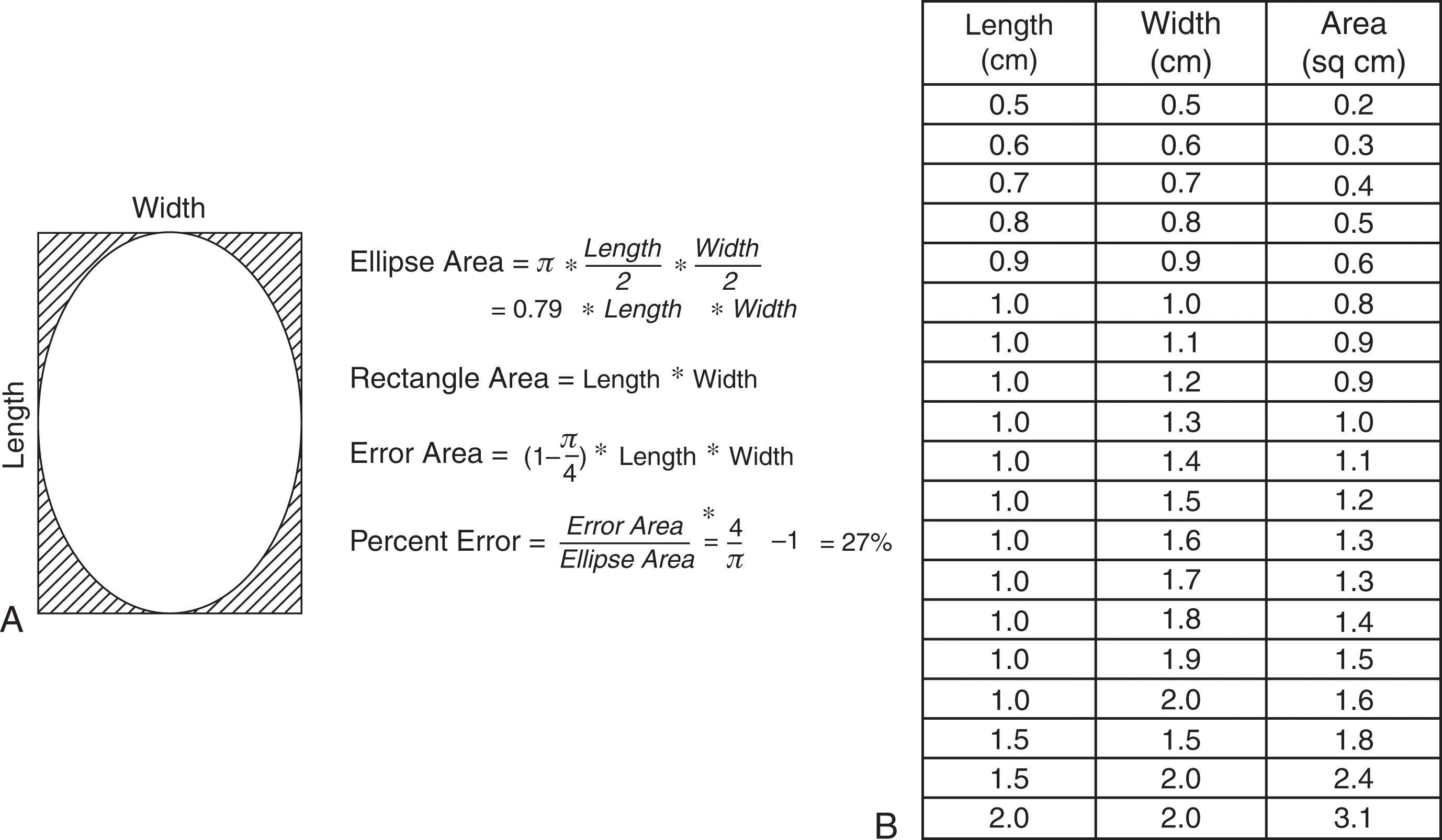 Fig. 40-7, Calculation of the area of an osteochondral lesion of the talus based on an ellipse versus a rectangle. A , Since most lesions are more elliptical in shape than rectangular, using the rectangular formula results in a 27% overestimation of lesion area. B , Area calculated using the elliptical method for common length and width combinations.