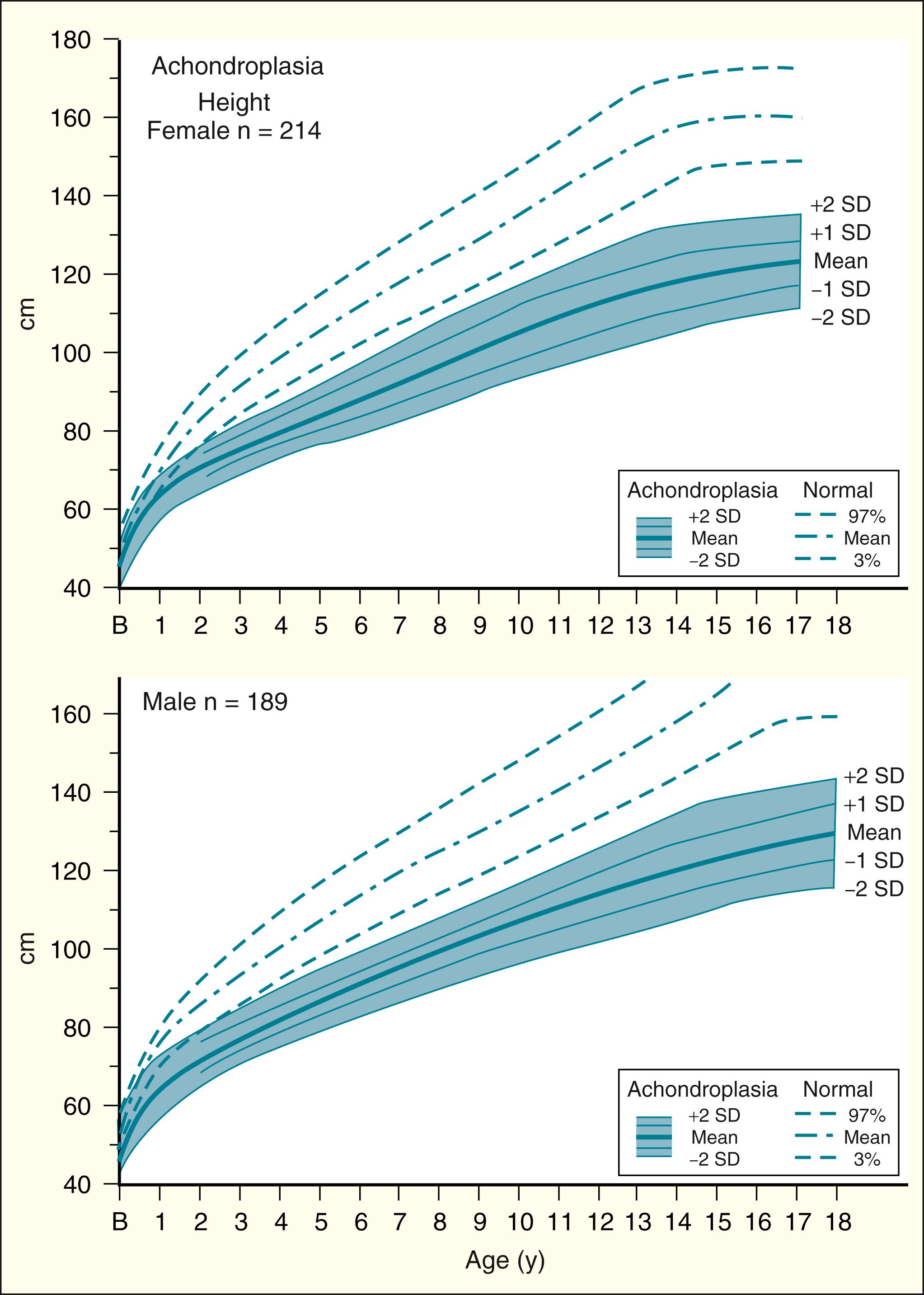 FIGURE 5, Note that approximately one-half of the newborn babies with achondroplasia are within normal limits for length at birth, but there is a progressive deceleration of growth rate beginning in infancy.