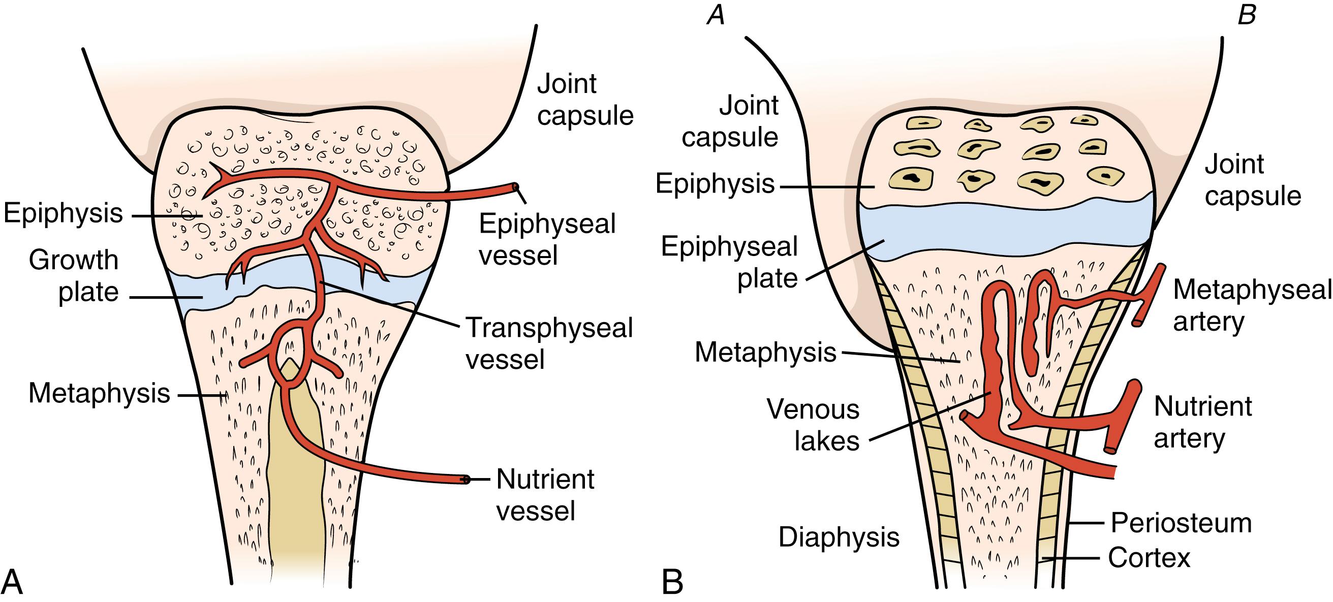 FIGURE 75.2, (A) Major structures of the bone of an infant before maturation of the epiphyseal growth plate. The transphyseal vessel connects the vascular supply of the epiphysis and metaphysis, thus facilitating spread of infection between these two areas. (B) Major structures of the bone of a child. Joint capsule A inserts below the epiphyseal growth plate, as in the hip, elbow, ankle, and shoulder. Rupture of a metaphyseal abscess in these bones is likely to produce pyogenic arthritis. Joint capsule B inserts at the epiphyseal growth plate, as in other tubular bones. Rupture of a metaphyseal abscess in these bones is likely to lead to a subperiosteal abscess but seldom to an associated septic joint.