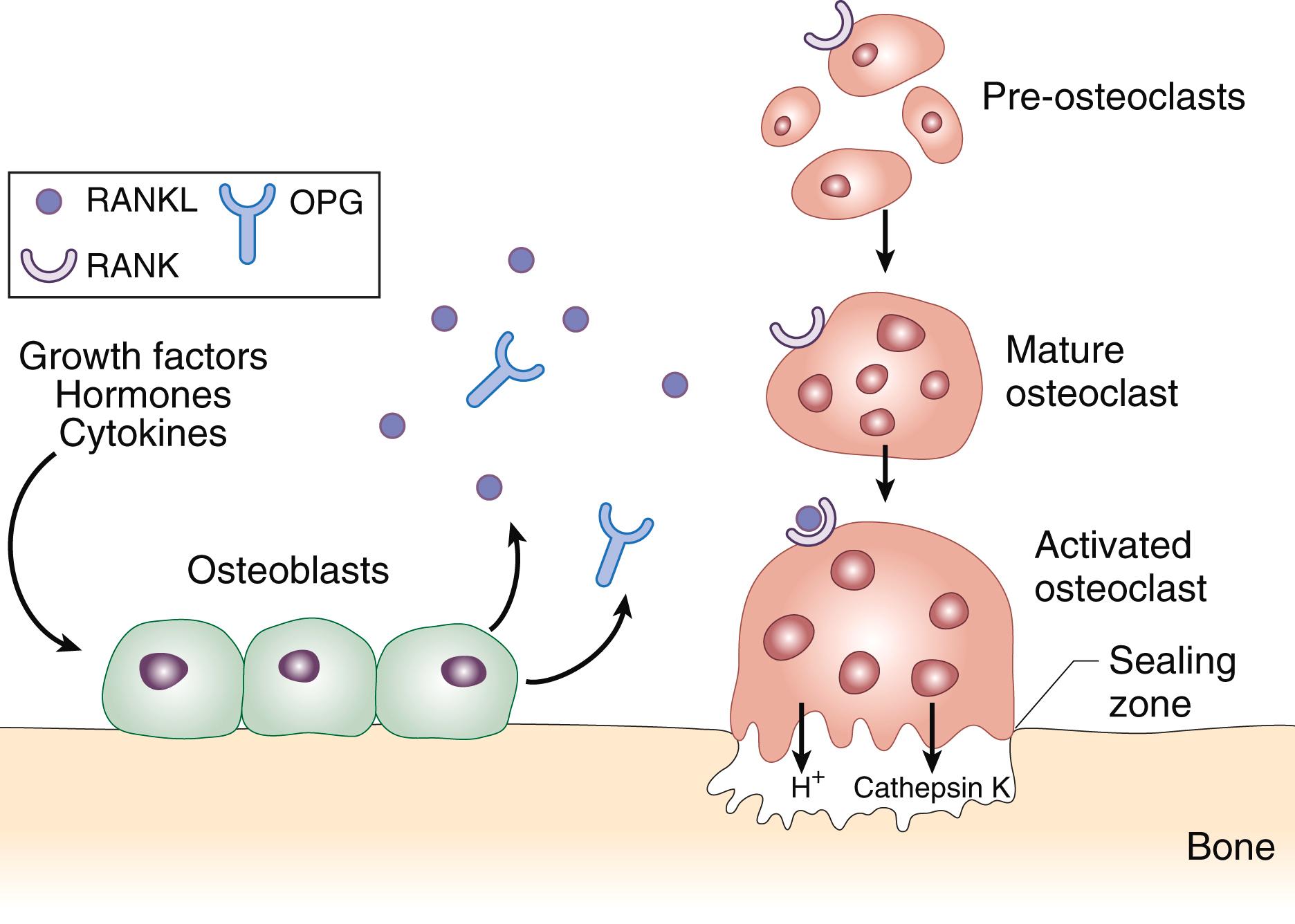 E-FIGURE 225-1, RANKL expressed by osteoblast lineage cells binds to RANK on the surface of pre-osteoclasts and mature osteoclasts, resulting in increased bone resorption through an increase in osteoclast differentiation, activity, and survival.