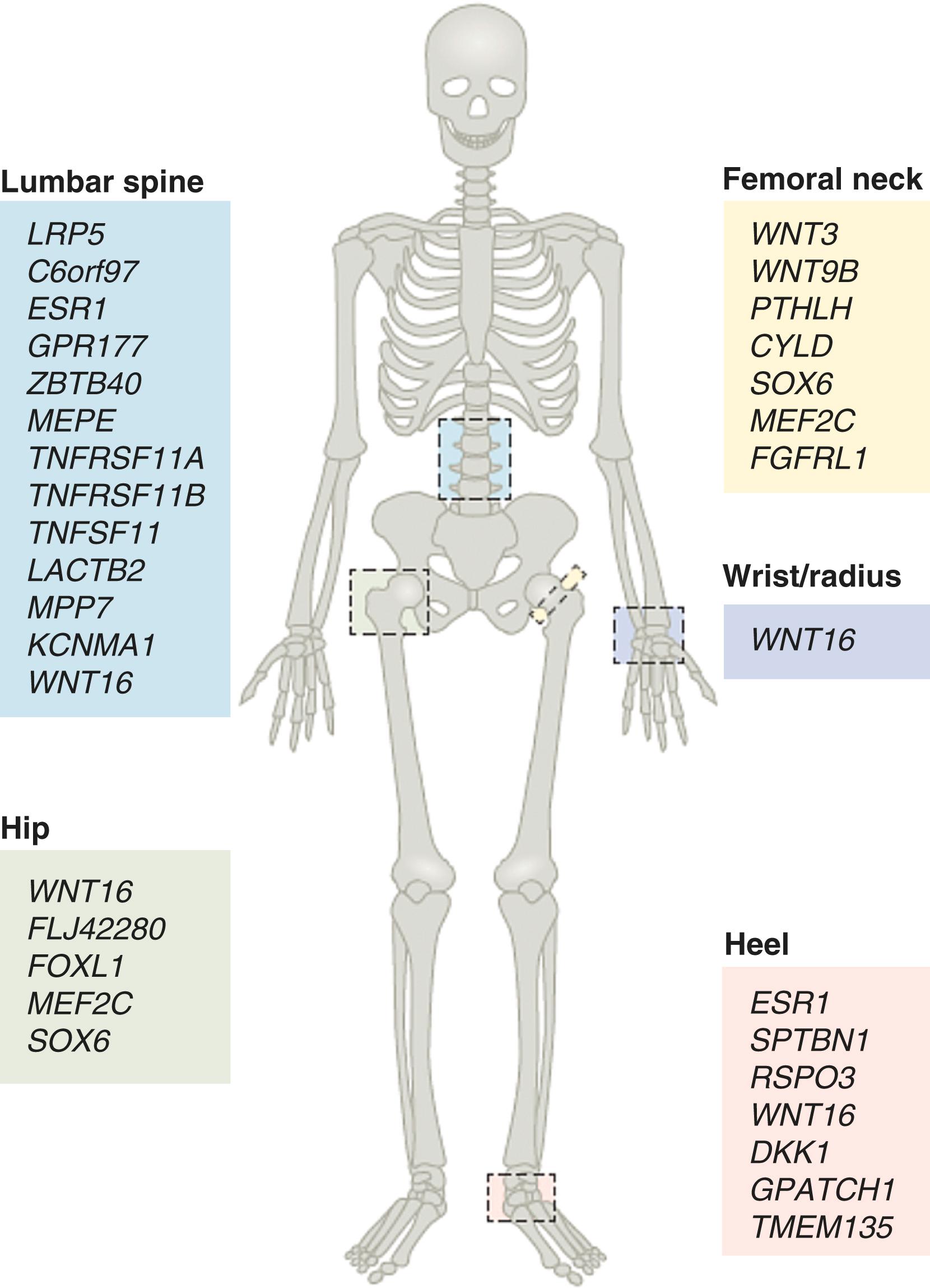 E-FIGURE 225-2, The most important genes linked to bone mineral density (BMD) variation.