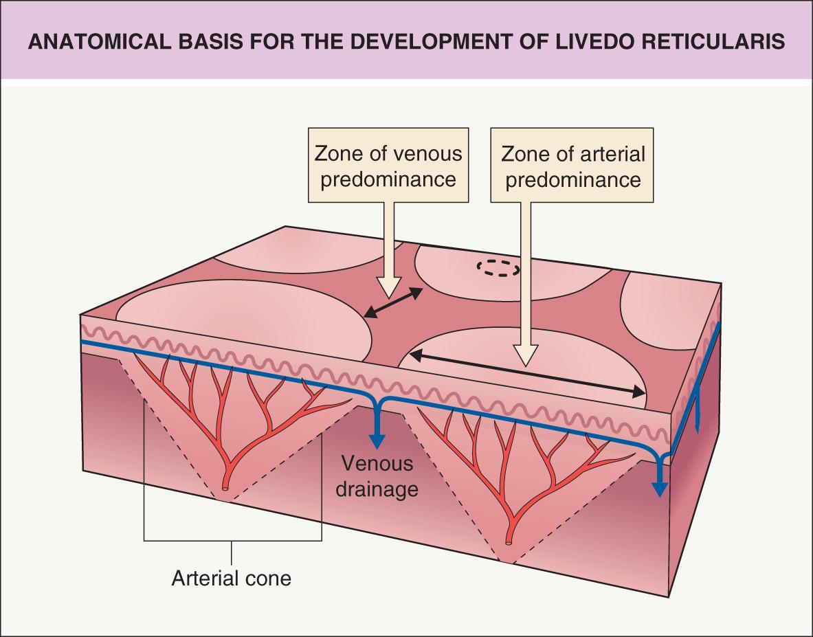 Fig. 106.1, Anatomical basis for the development of livedo reticularis.