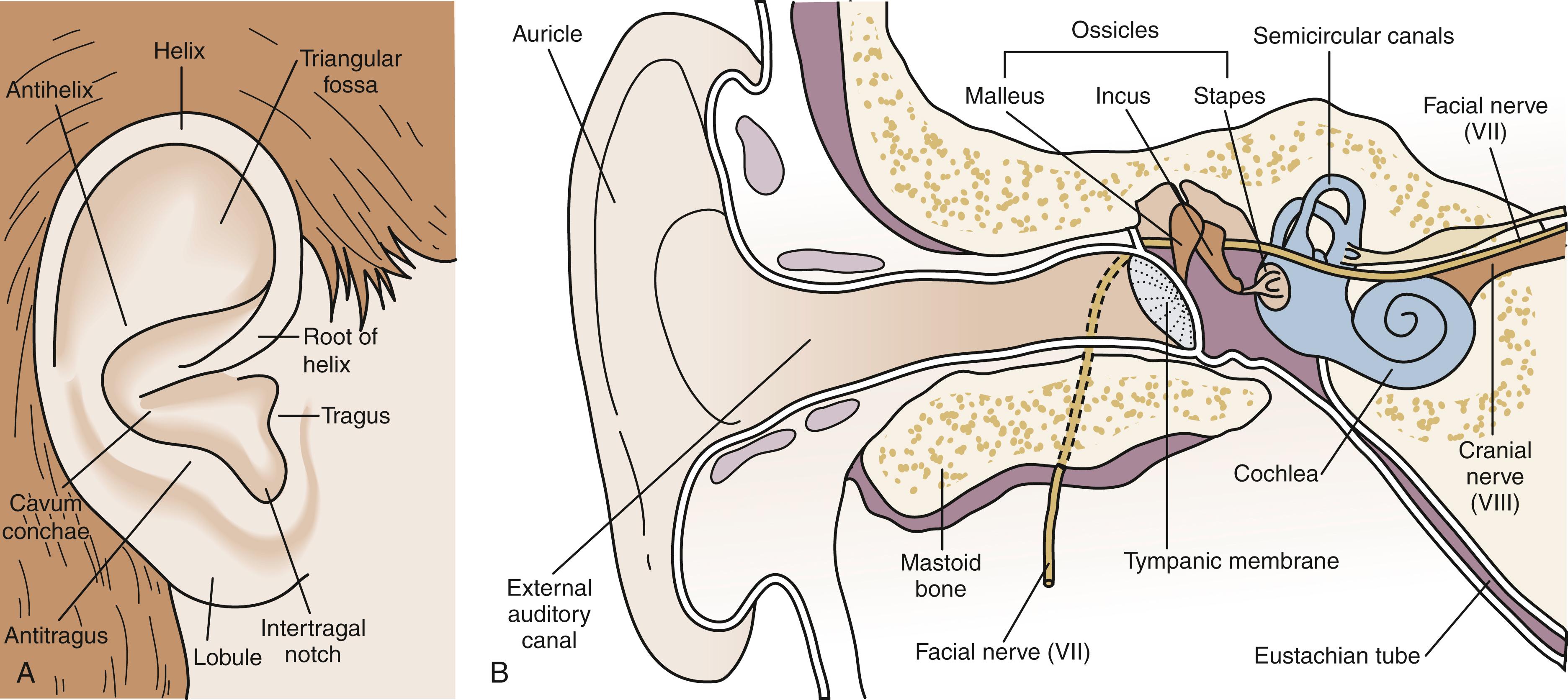 Fig. 24.2, Anatomy of the ear. (A) A normal external ear (auricle or pinna) is shown, with its various landmarks labeled. It is helpful to refer to such a diagram in assessing congenital anomalies. (B) Coronal section shows the various structures of the hearing and vestibular apparatus. The three main regions are the external ear, middle ear, and inner ear. The eustachian tube connects the middle ear and the nasopharynx and serves to drain and ventilate the middle ear.
