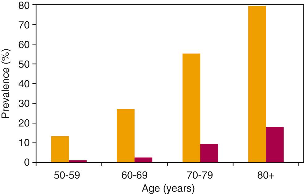 Fig. 13.1, Prevalence of hearing loss (orange bars) and hearing aid use (red bars) in adults aged 50 years and older in the United States.