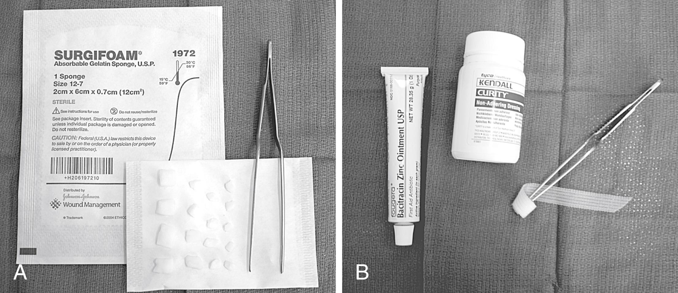 Fig. 1.23, (A) Surgifoam packing. (B) Meatoplasty packing.