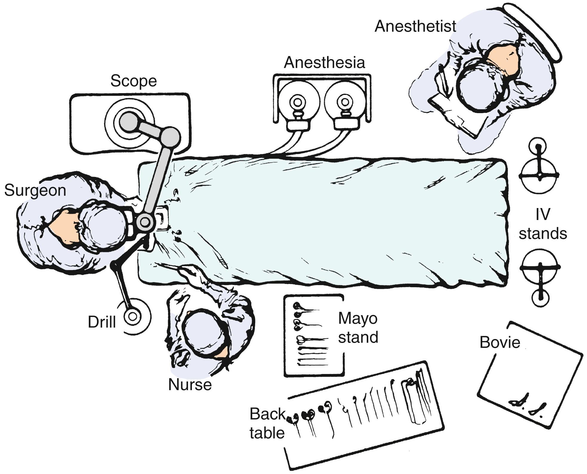 Fig. 1.10, Operating room layout for middle fossa surgery.