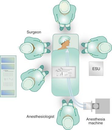 FIGURE 33.2, An operating room table turned 180 degrees may limit access to the child during ear surgery. ESU is the electrosurgical unit.