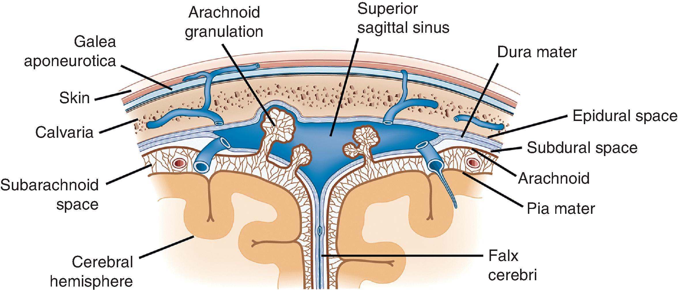 FIGure 1.1, Coronal view of skull, meninges, and brain demonstrating anatomic relations.