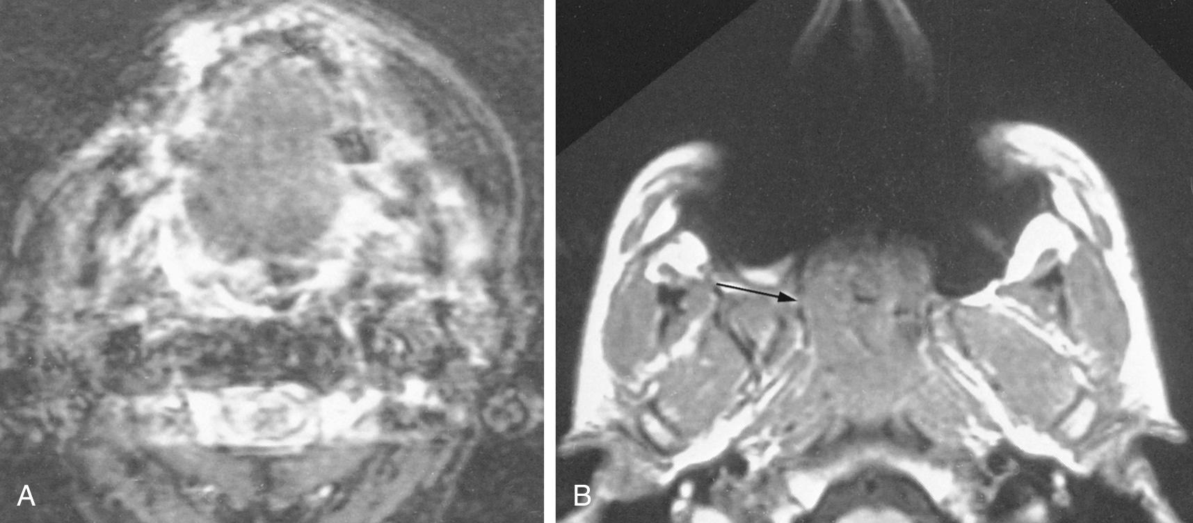 Fig. 8.5, Magnetic resonance imaging artifacts.