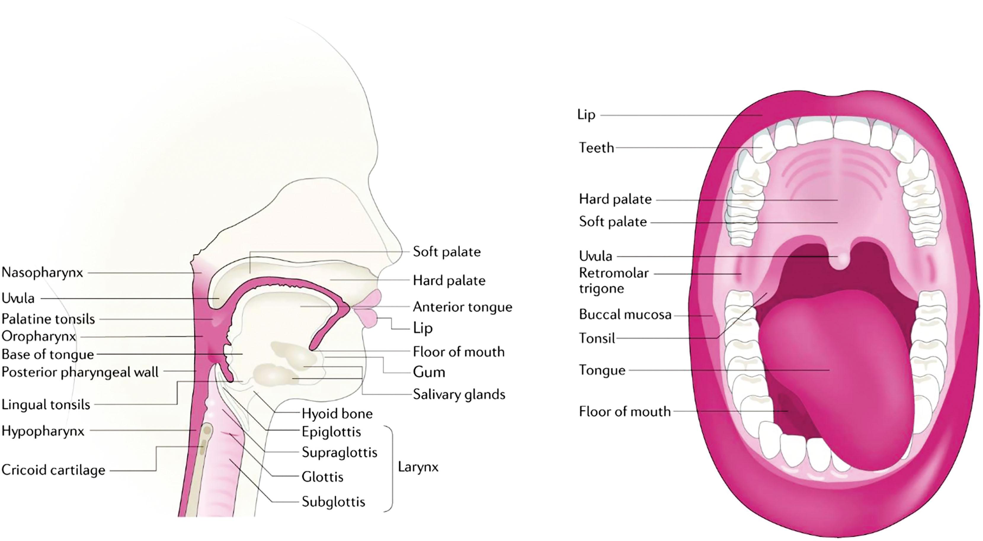 Figure 8.1, Anatomical sites of HNSCC development. Head and neck squamous cell carcinoma (HNSCC) arises from the mucosal epithelium of the oral cavity (lips, buccal mucosa, hard palate, anterior tongue, floor of mouth, and retromolar trigone), nasopharynx, oropharynx (palantine tonsils, lingual tonsils, base of tongue, soft palate, uvula, and posterior pharyngeal wall), hypopharynx (the bottom part of the throat, extending from the hyoid bone to the cricoid cartilage), and larynx. Human papilloma virus-associated HNSCCs arise primarily from the palantine and lingual tonsils of the oropharynx, whereas tobacco-associated HNSCCs arise primarily in the oral cavity, hypopharynx, and larynx.