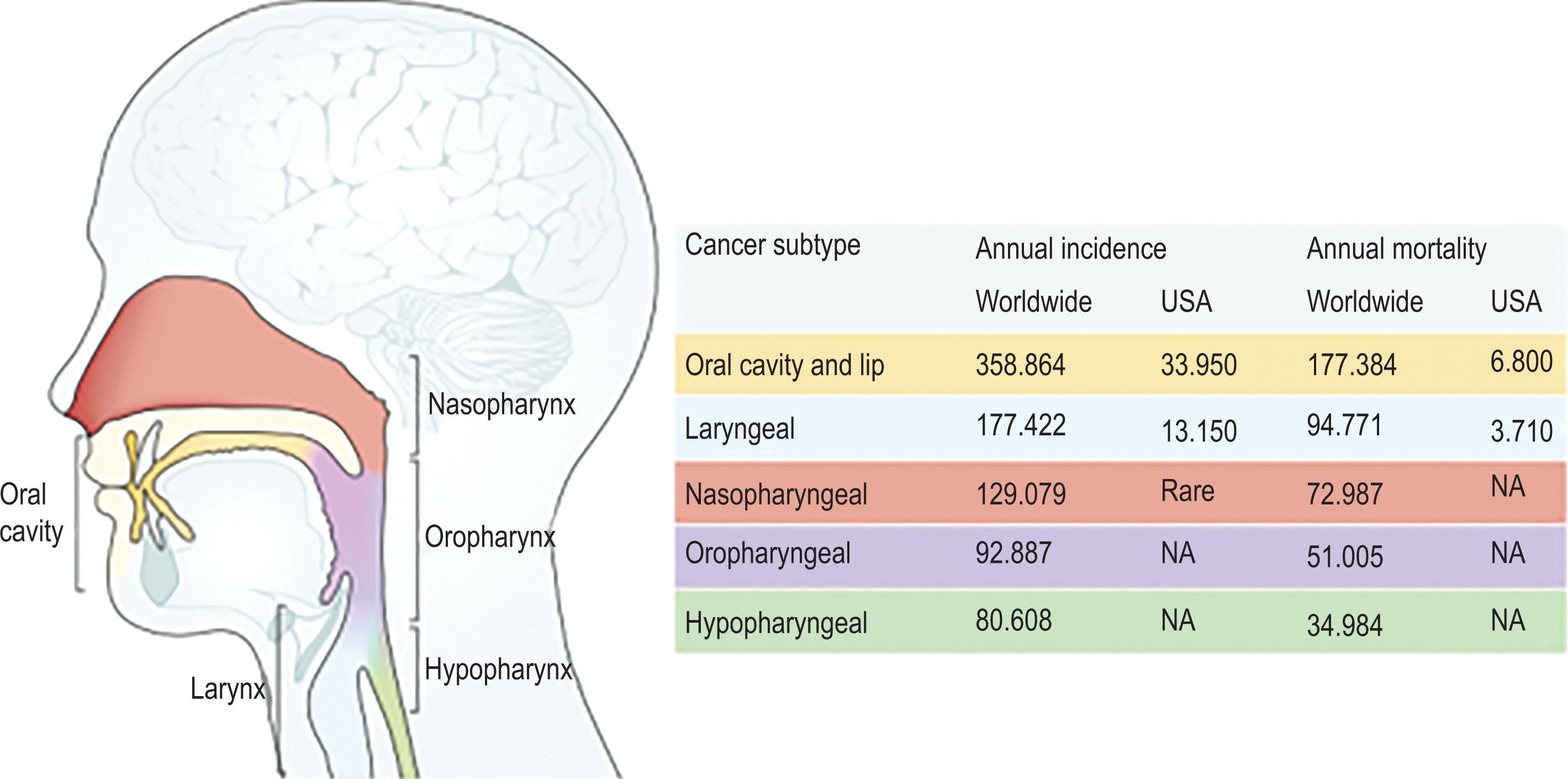 Figure 8.2, Incidence and mortality rates for patients with head and neck squamous cell carcinoma (HNSCC). Results of worldwide and US investigations of the epidemiology of HNSCC are shown; national databases frequently group different subtypes together (for example, oral cancers and pharyngeal cancers). For this reason, some oropharyngeal cancers of the base of the tongue can be misclassified as cancers of the oral cavity. Furthermore, the incidence of human papillomavirus (HPV)-associated oropharyngeal cancer is regionally specific: HPV accounts for 70% of oropharyngeal cancers in the US and for 10% in low-income and middle-income countries. The incidence of nasopharyngeal cancer is included as it significantly impacts the global burden of head and neck cancer, particularly in Southeast Asia, although the incidence is low in the US. NA, Not applicable.