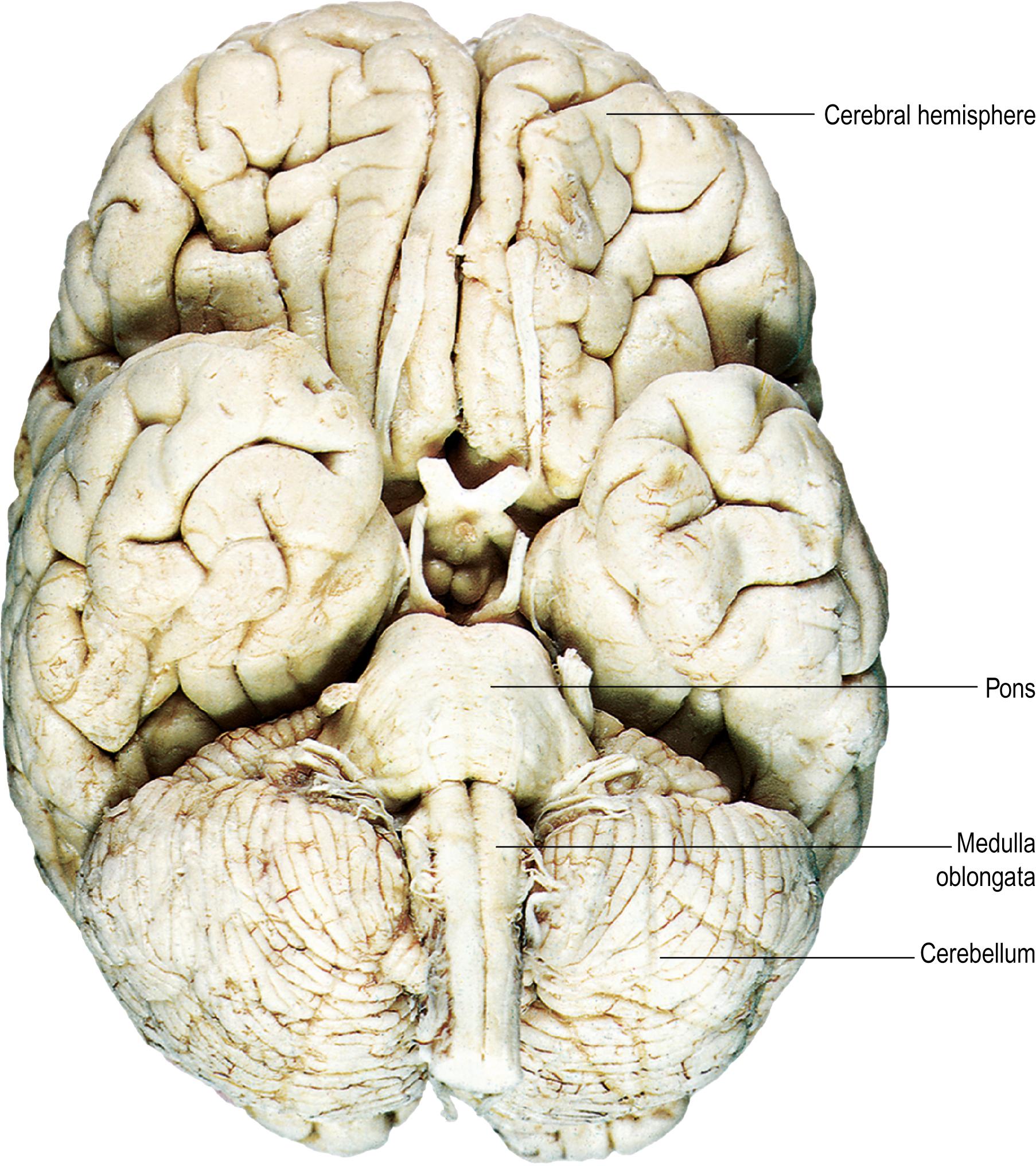 Fig. 24.5, The base of the brain, showing the major divisions and cranial nerves.