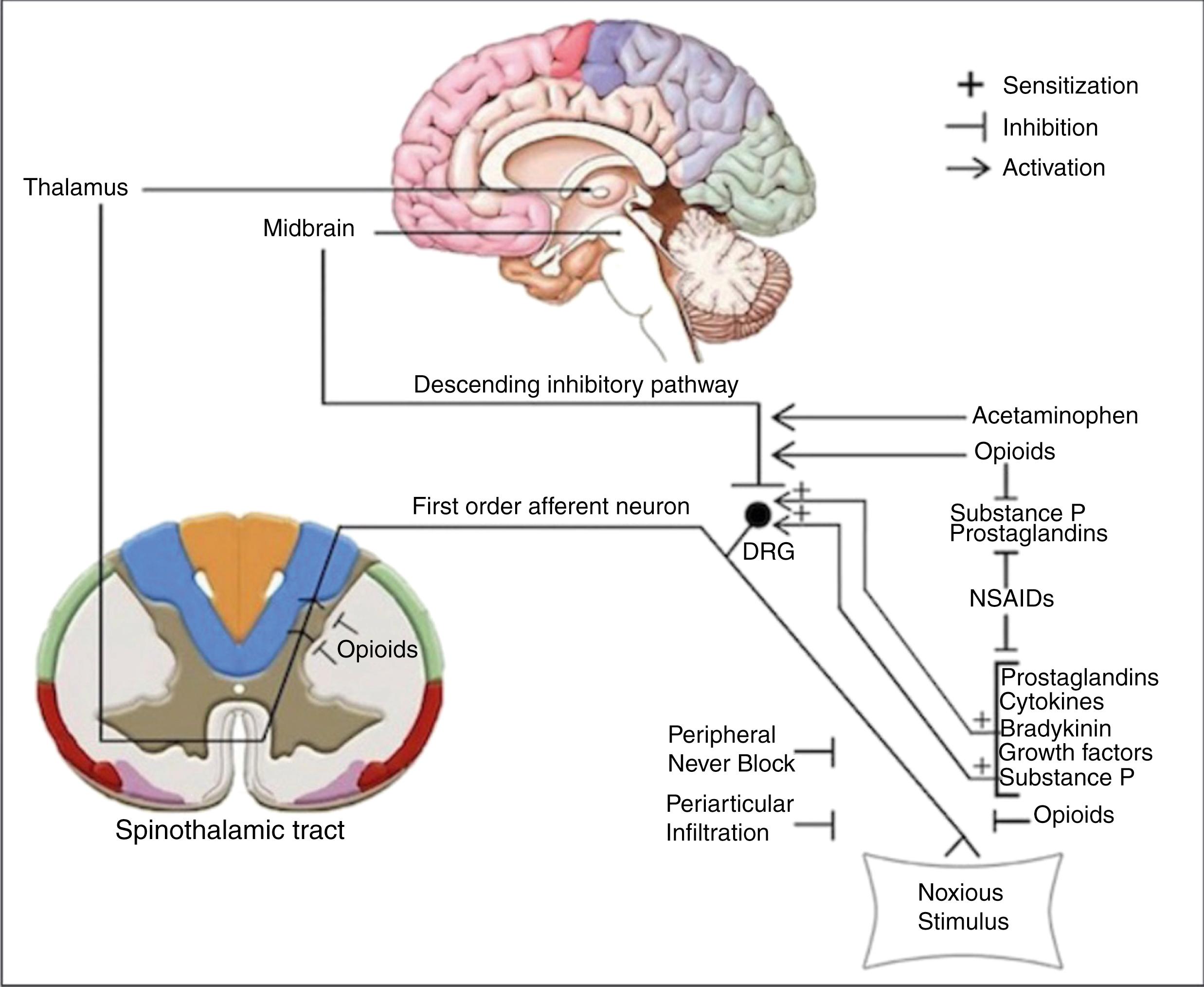 Fig. 3.1, Pain pathway and sites of action for various analgesic medications.