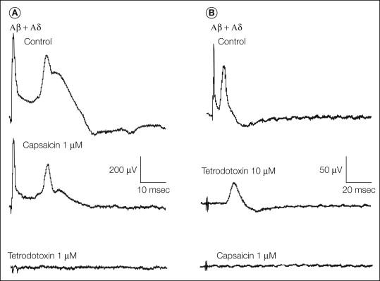 Figure 65-6, Compound action potential recordings from a human sural nerve in vitro.