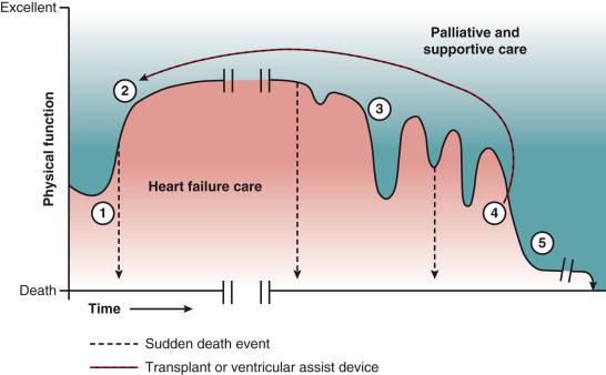 Fig. 52.1, Comprehensive heart failure care. Time point 1 illustrates initial diagnosis of heart failure, in which care emphasizes initiation of evidence-based therapies, education of patient and family about the disease, and how to manage it. Time point 2 is the plateau phase, in which treatment has been initiated and quality of life is improved from initial diagnosis. Patients remain in this stage and benefit from medical management, a variable length of time until time point 3, with oscillating exacerbation and rescue with decline in physical function, increased need for supportive care, and perhaps increasing frequency of hospitalizations. Time point 4 is generally a crossroad phase in which advanced therapies, such as a left ventricular assist device or transplant, may bring patients back to a new plateau. Alternatively, progression of disease to time point 5 occurs, characterized by low function, frailty, and significant need for palliative therapies, with variable length of time until death.